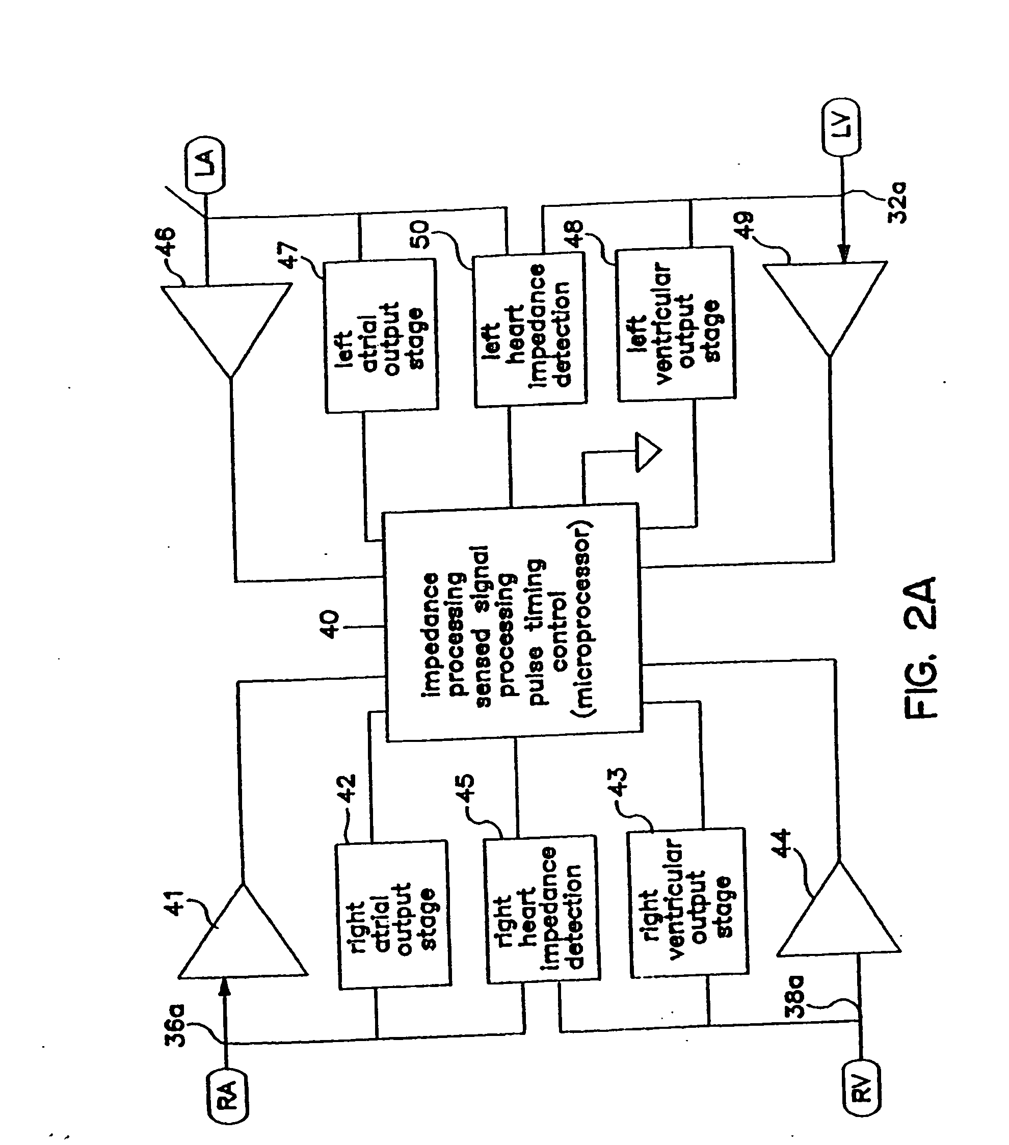 Algorithm for the automatic determination of optimal pacing intervals