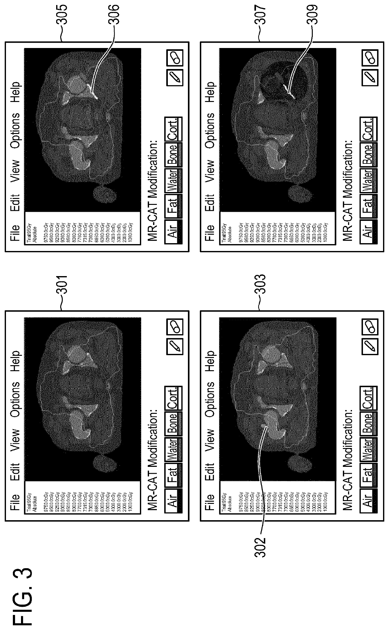 Radiotherapy planning with improve accuracy