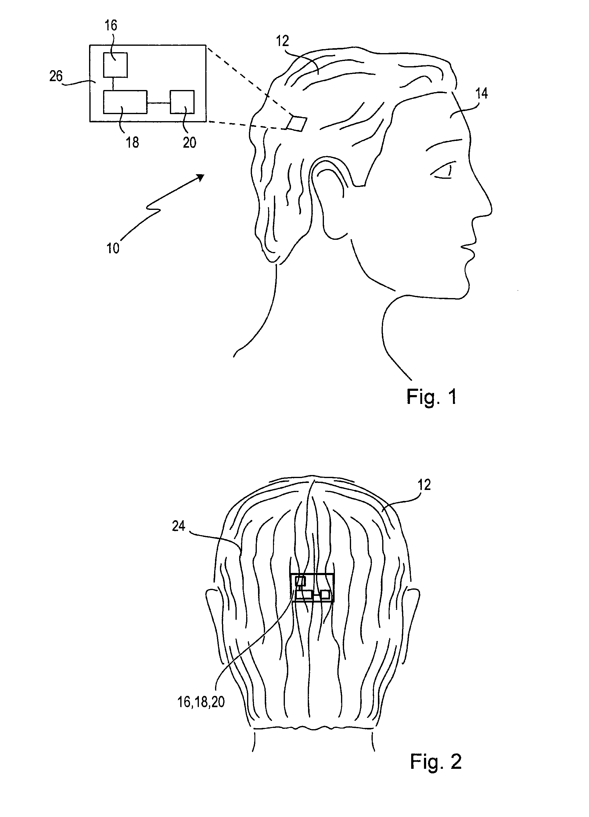 Wearable computing device