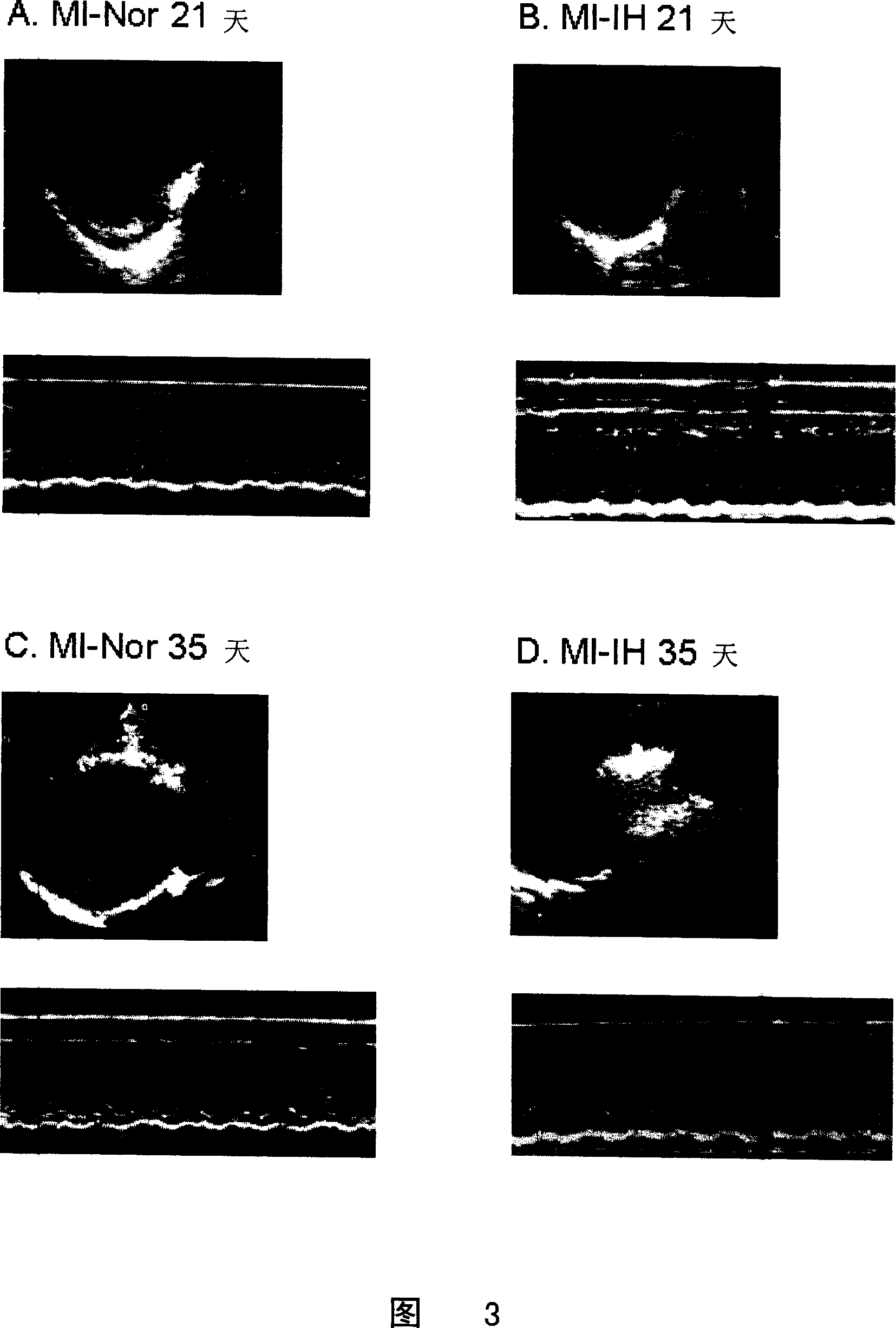 Therapeutic action of intermittent hypoxia for treating myocardiac infarction