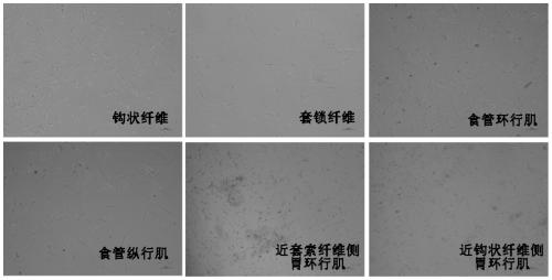 A kind of primary culture and identification method of esophagogastric junction smooth muscle cells by enzymatic digestion