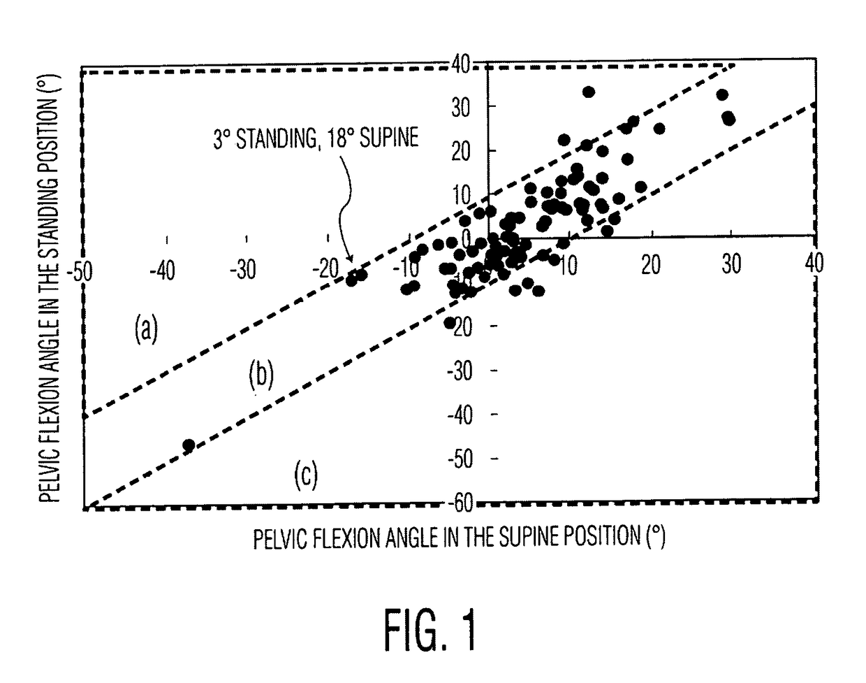 Patient specific implantation method for range of motion hip impingement