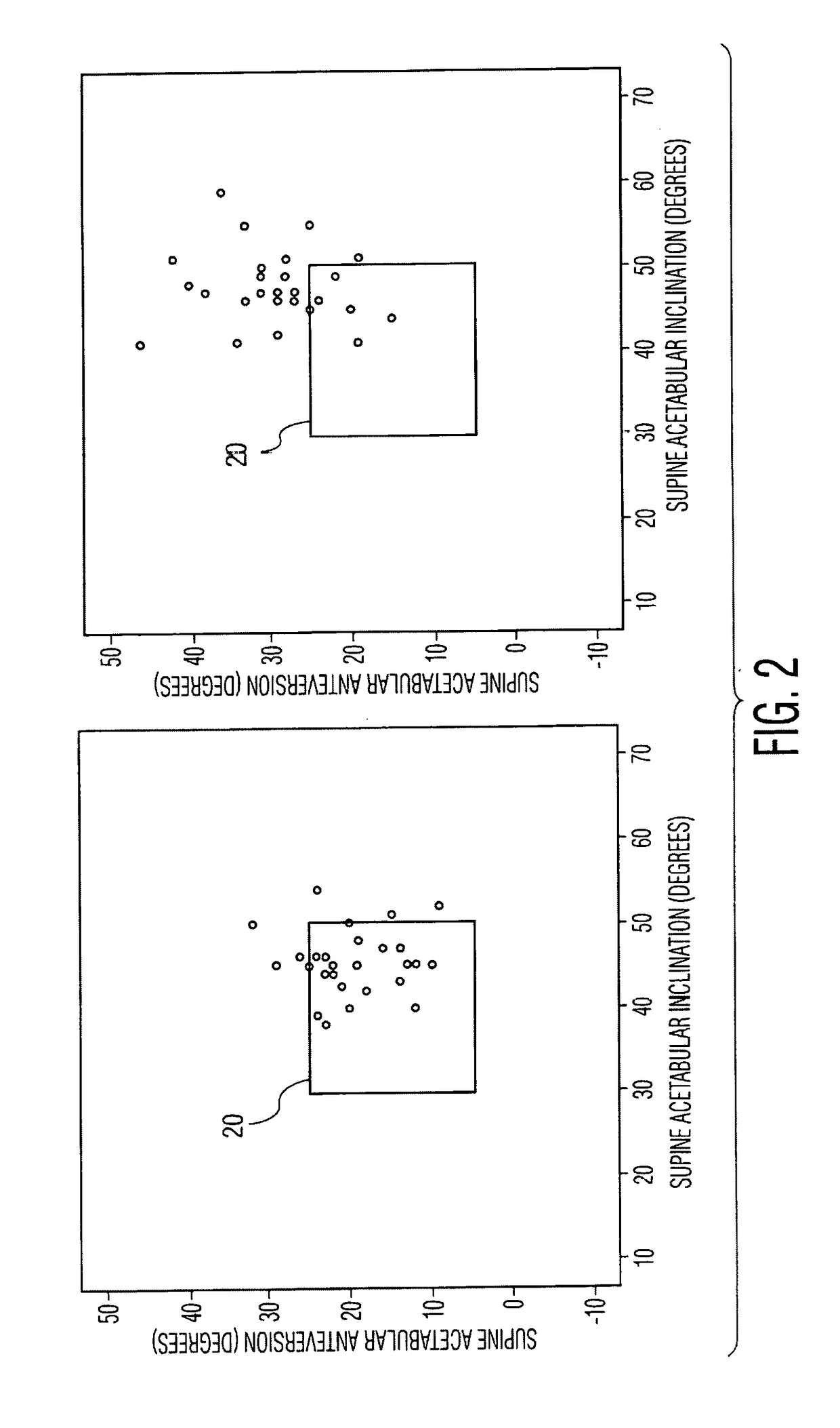 Patient specific implantation method for range of motion hip impingement