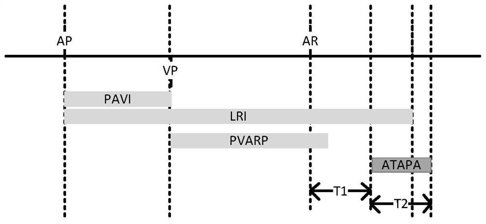 Pulse stimulation equipment capable of effectively avoiding pacing in atrial vulnerable period