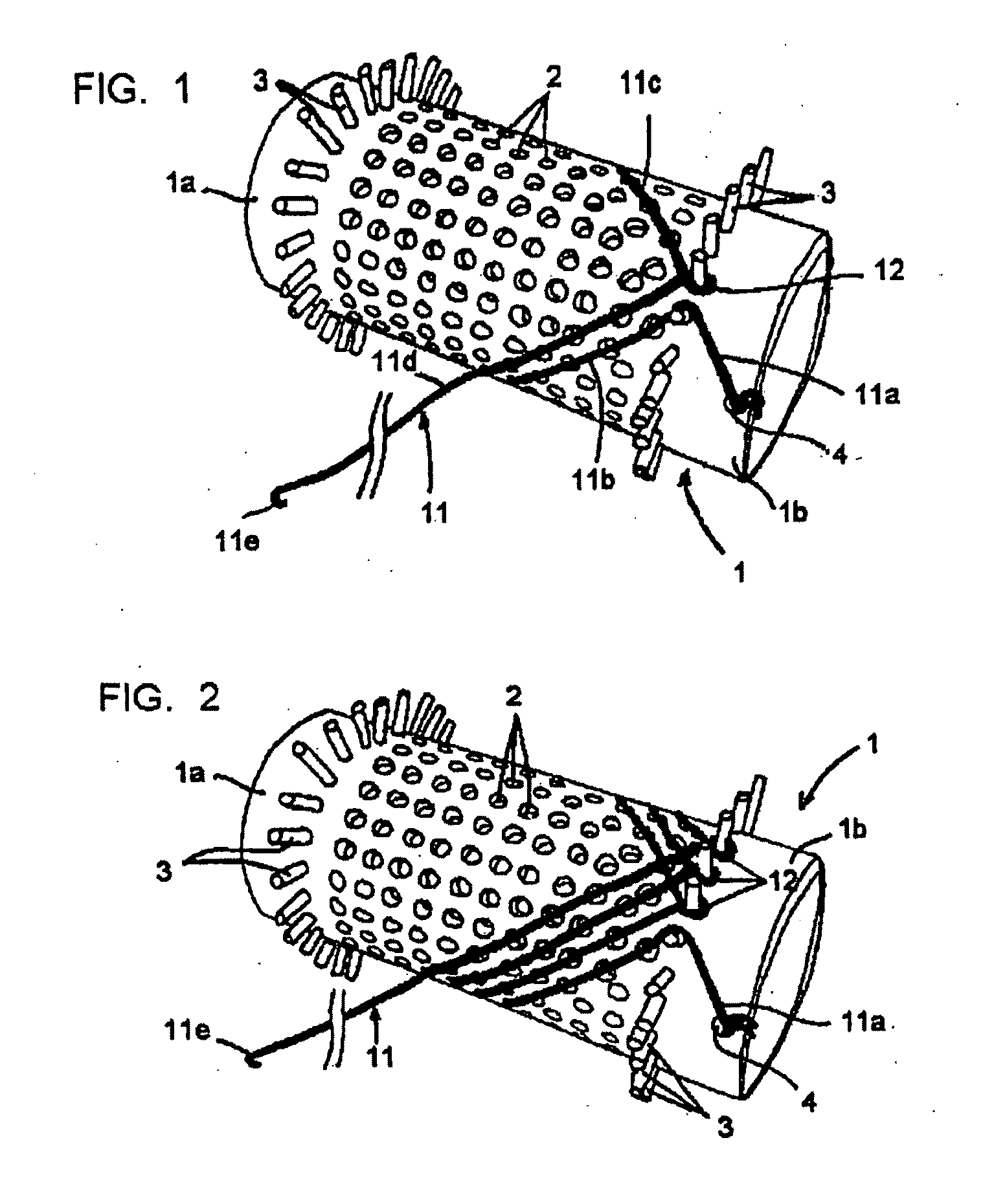 Vascular Stents, Methods of Use and Methods of Manufacture