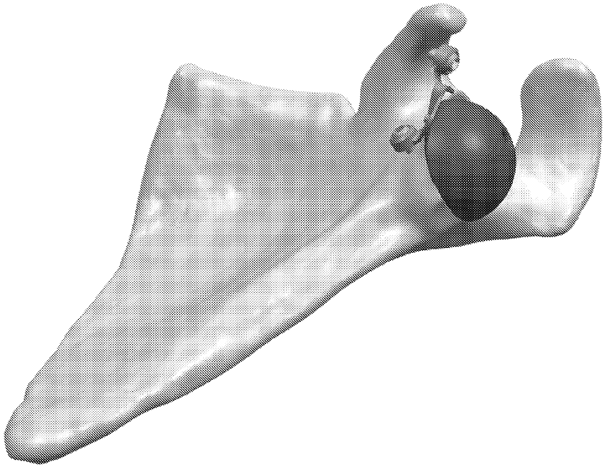 Platform rtsa glenoid prosthesis with modular attachments capable of improving initial fixation, fracture reconstructions, and joint biomechanics