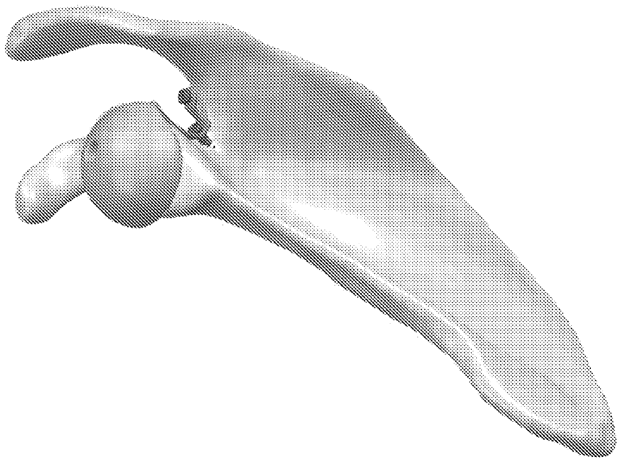 Platform rtsa glenoid prosthesis with modular attachments capable of improving initial fixation, fracture reconstructions, and joint biomechanics