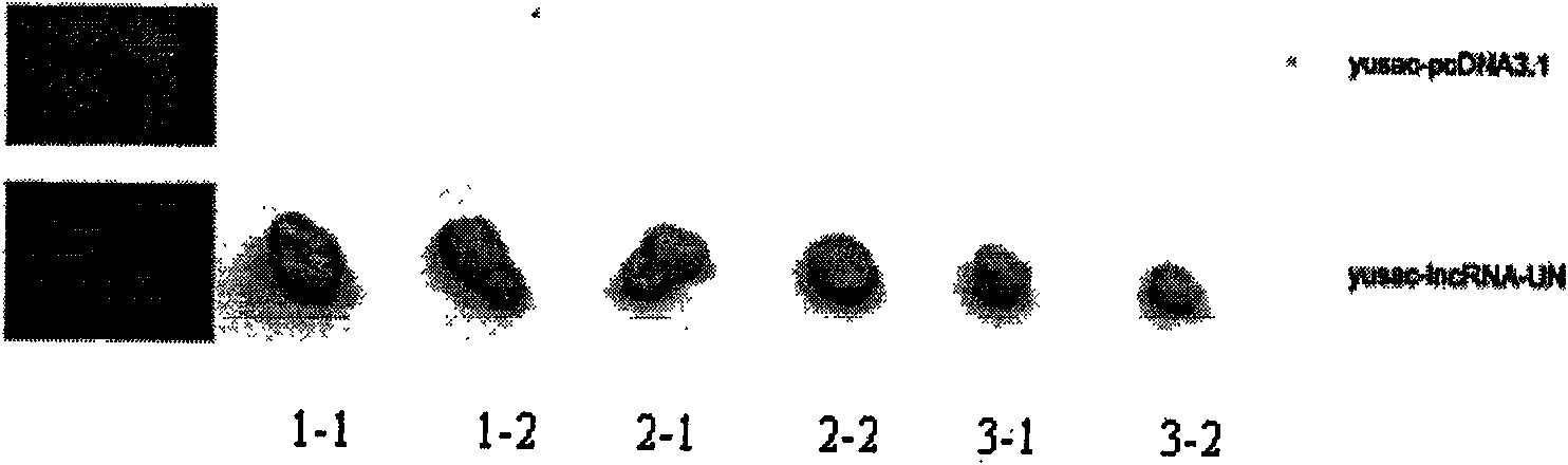 Long non-coding RNA sequence of human melanoma cell specific expression and application thereof