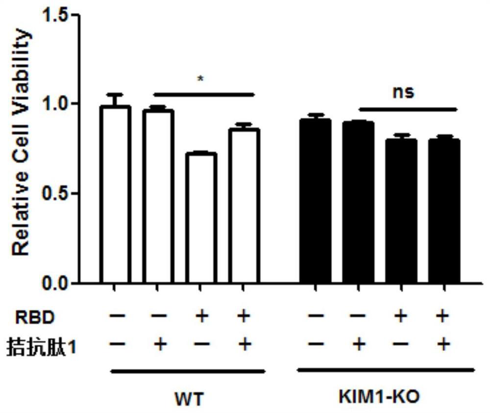 Antagonistic polypeptide and application thereof in preparation of novel coronavirus resistant drugs