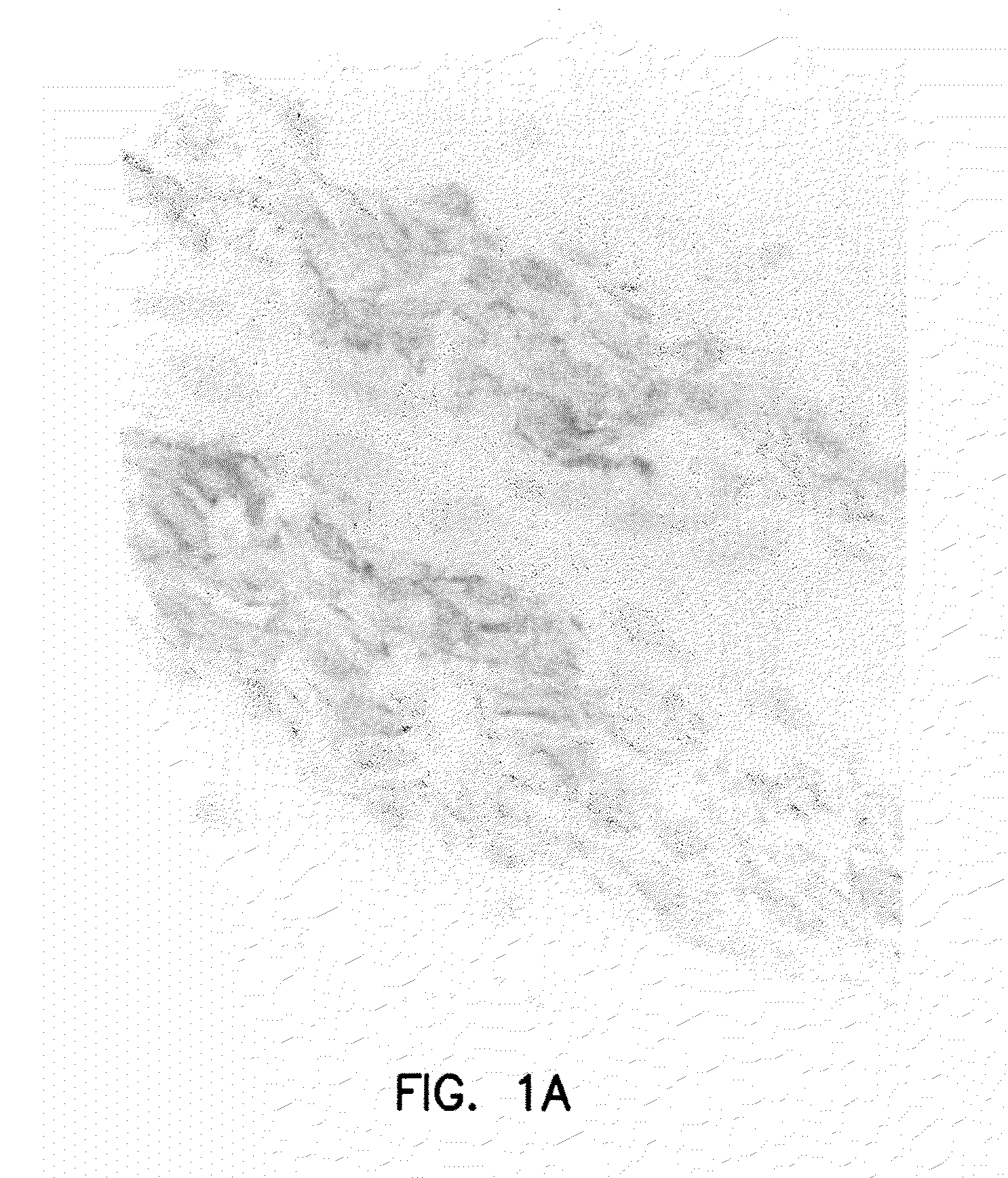 Therapeutic inhibitor of vascular smooth muscle cells