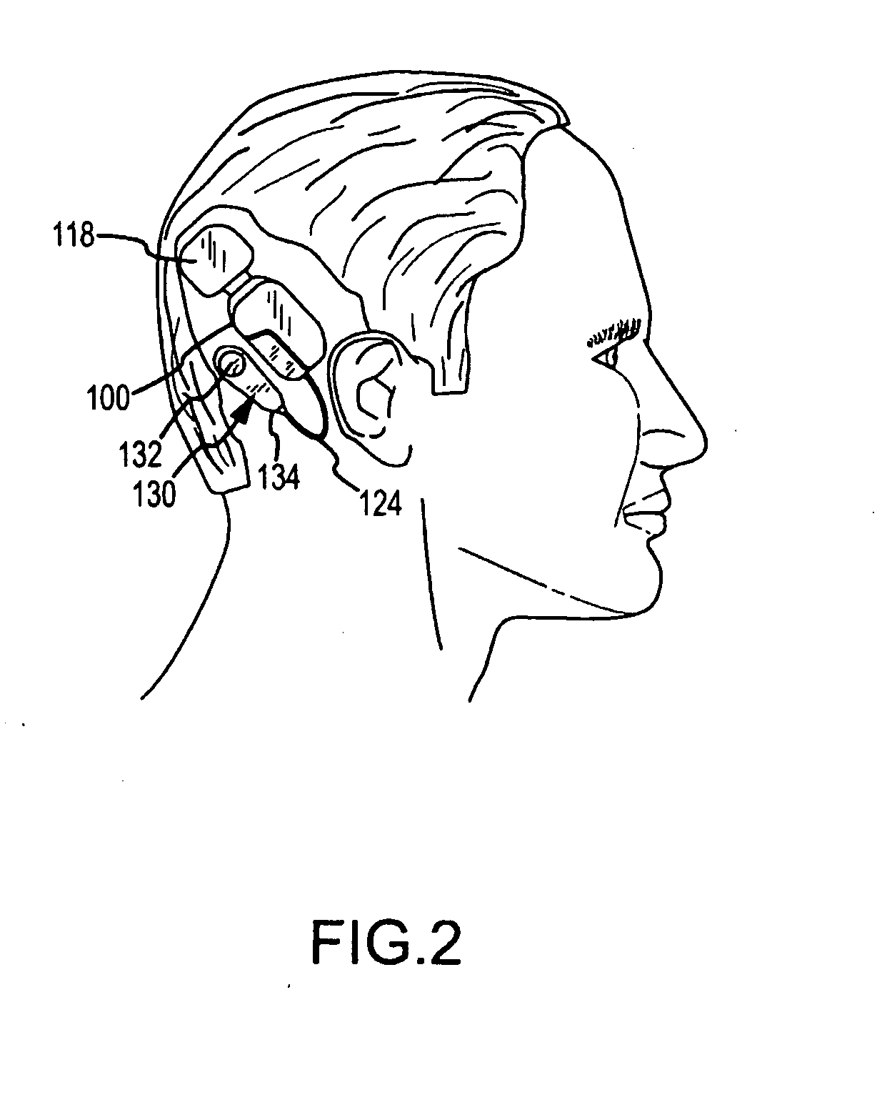 Fluid cushion support for implantable device