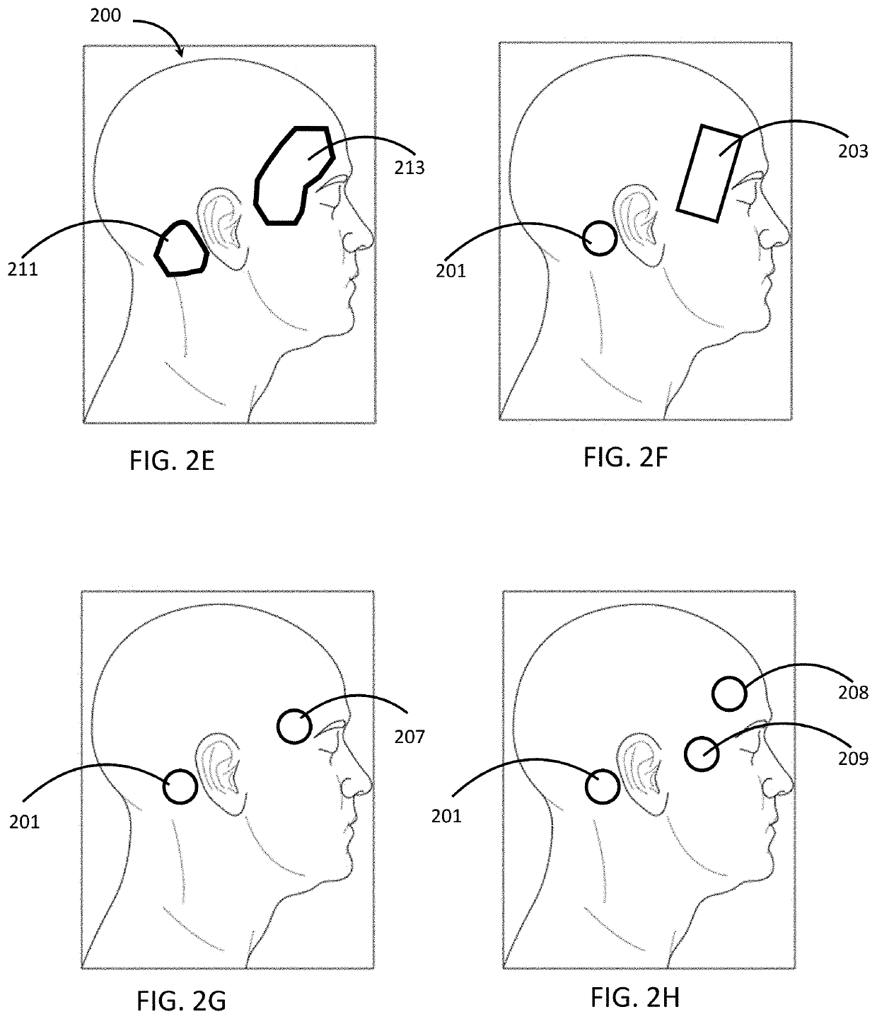 Apparatuses and methods for transdermal electrical stimulation of nerves to modify or induce a cognitive state