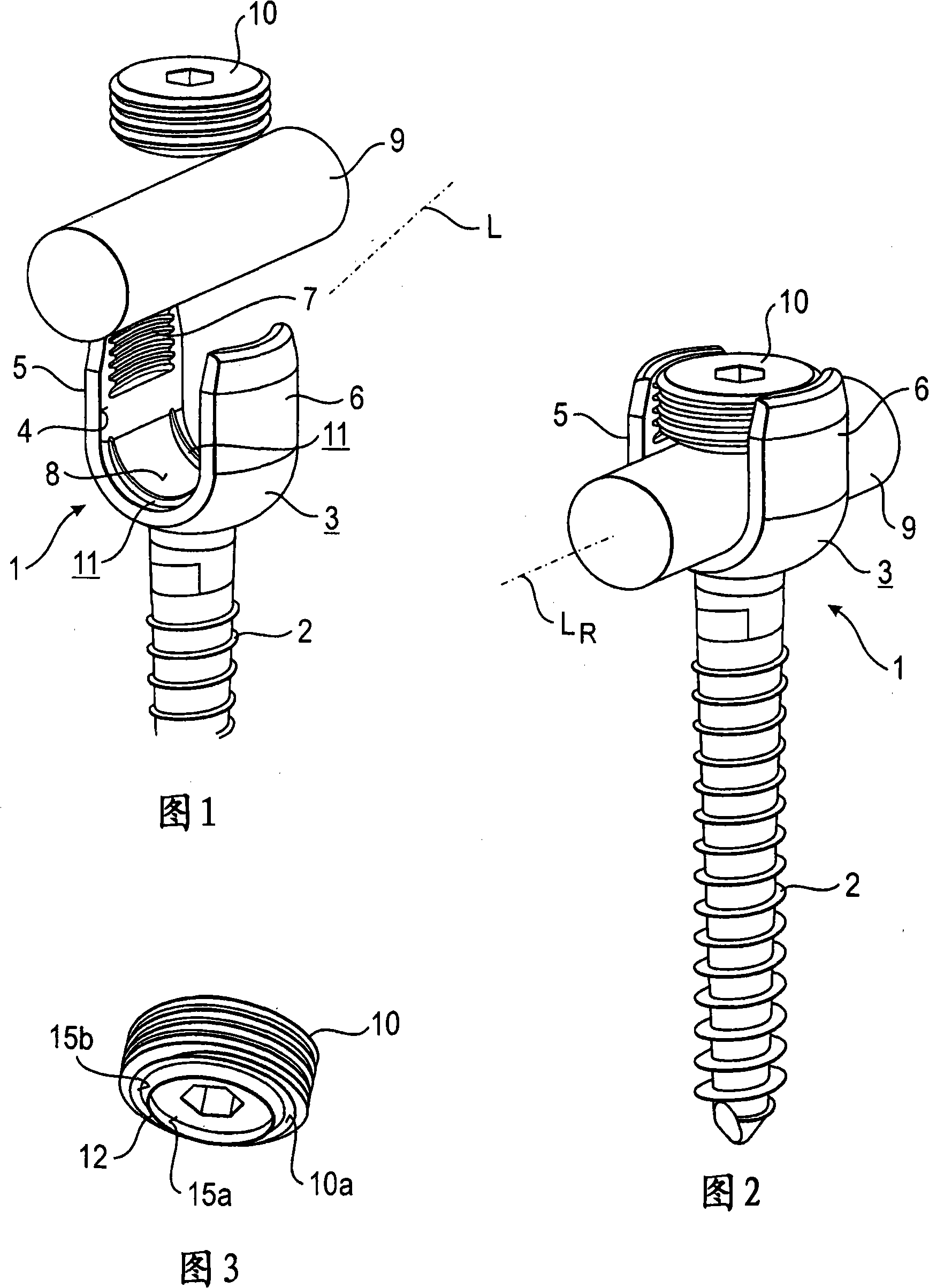 Bone anchoring device