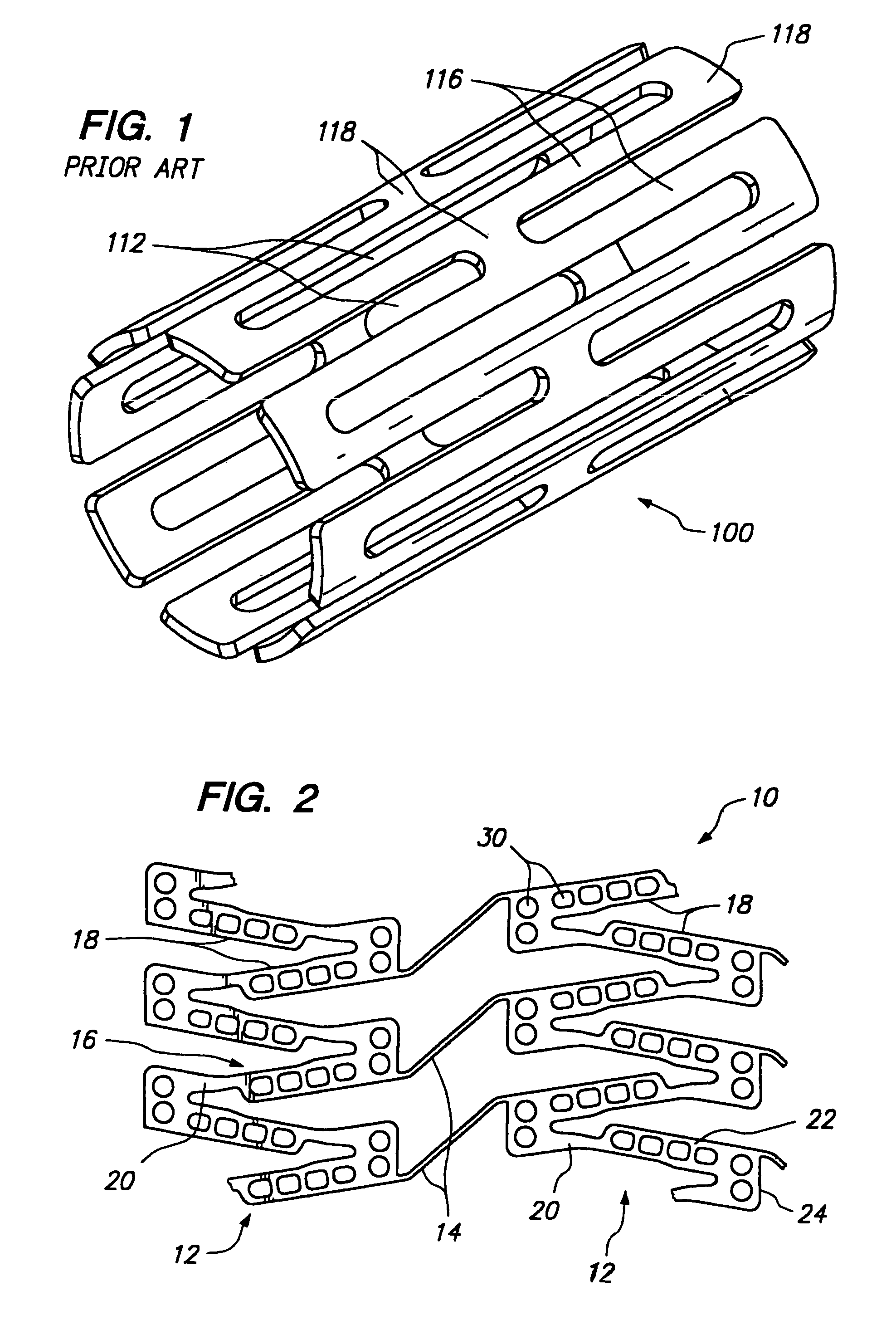 Expandable medical device with improved spatial distribution