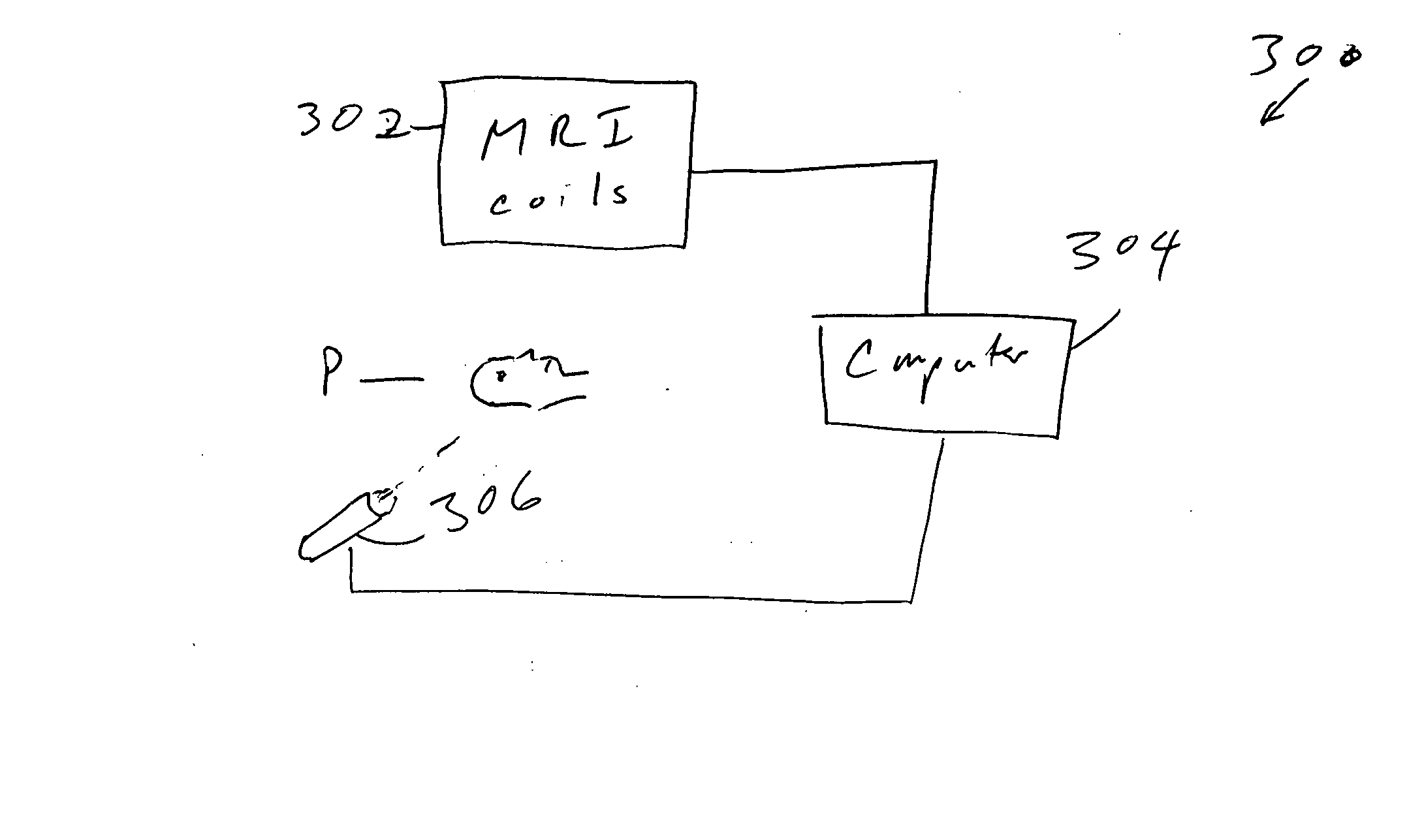 Prediction and treatment of brain tumor spread using MRI and external beam radiation