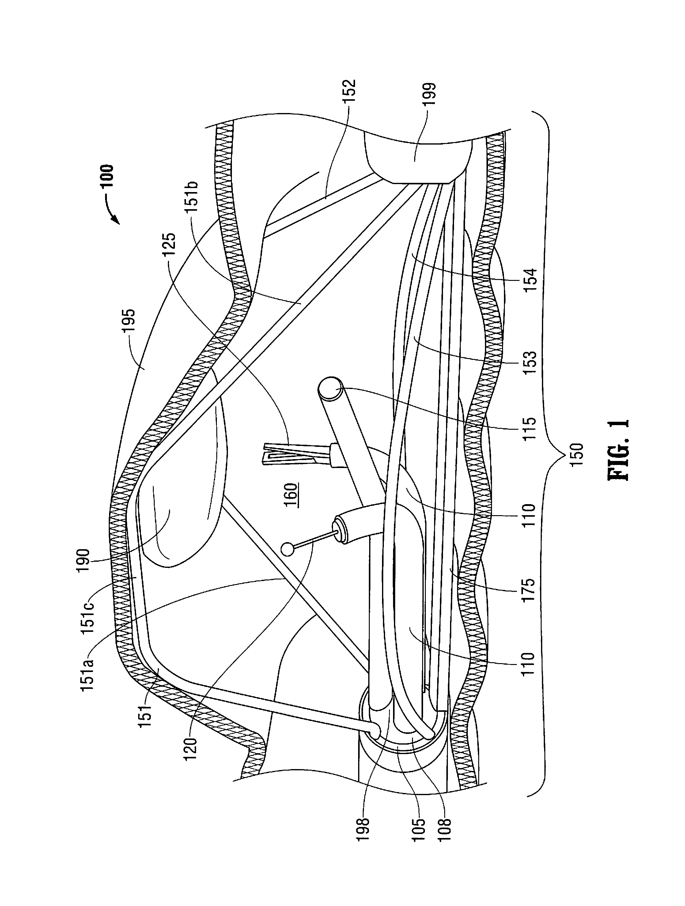 Multi-lumen-catheter retractor system for a minimally-invasive, operative gastrointestinal treatment