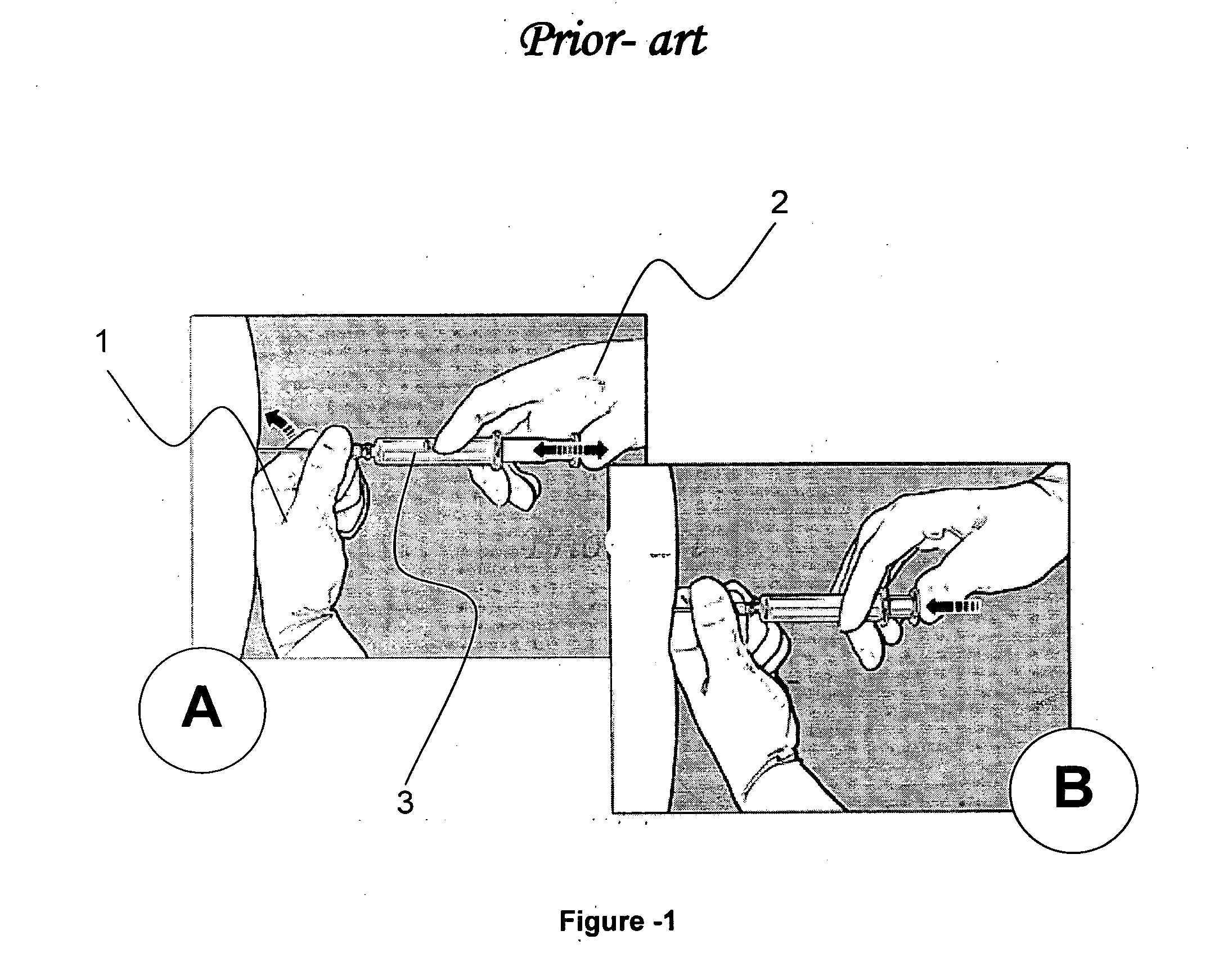 Device for locating epidural space while safeguarding against dural puncture through differential friction technique