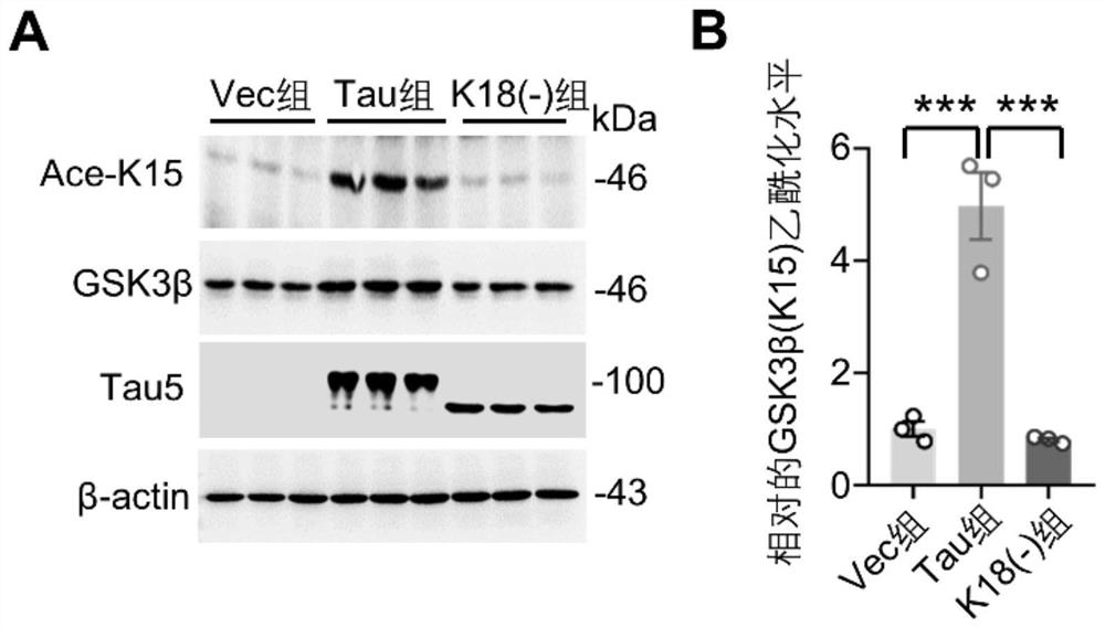 Polypeptide for inhibiting glycogen synthase kinase-3[beta] acetylation, coding gene of polypeptide and application of polypeptide and coding gene