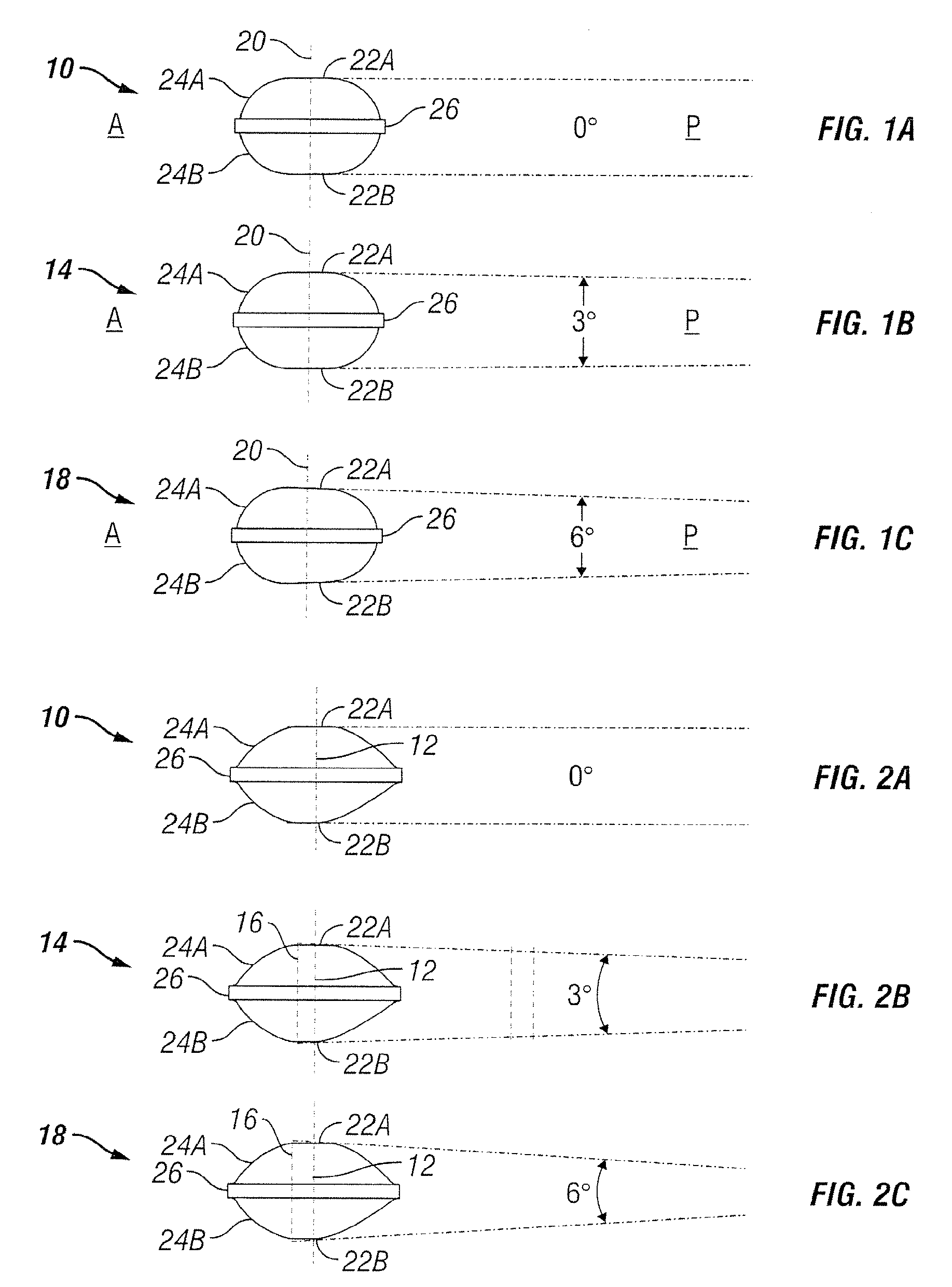 Joint prostheses