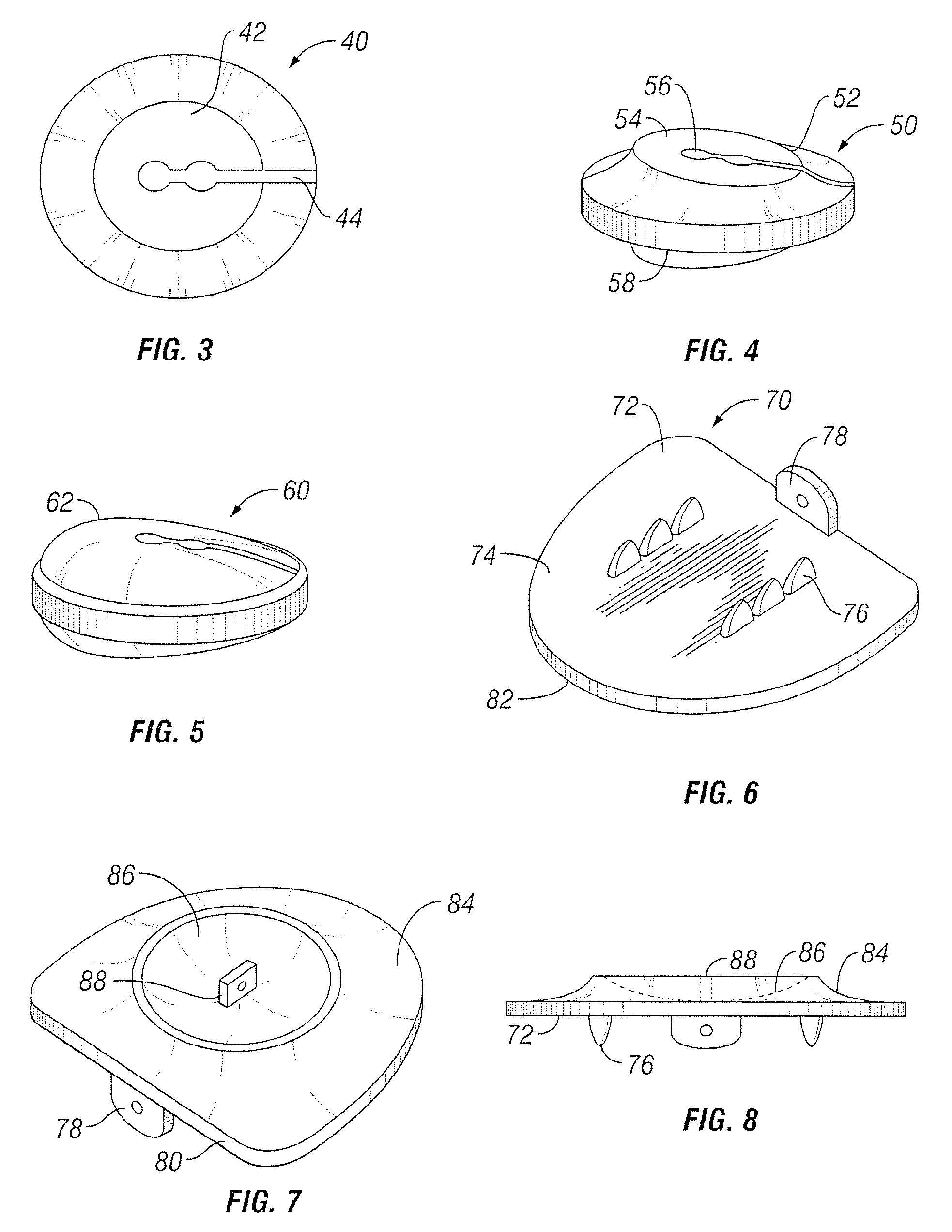 Joint prostheses