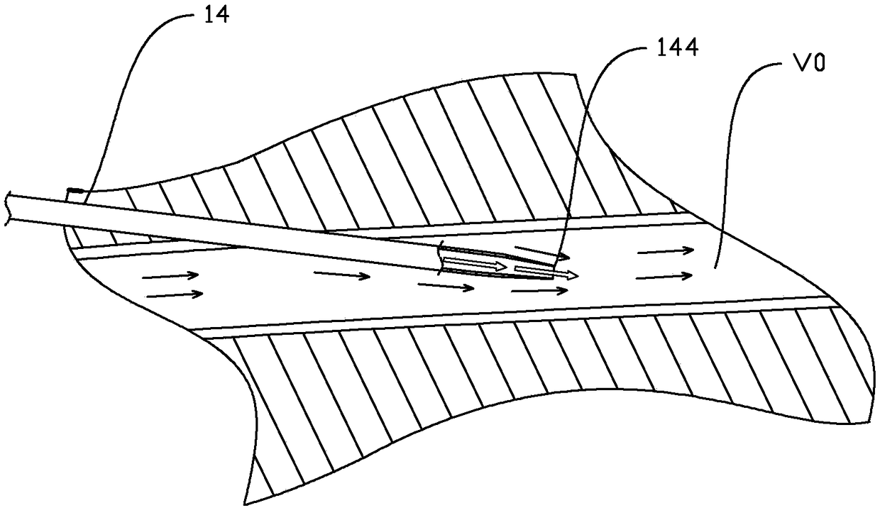 Blocking type intravenous infusion catheter device