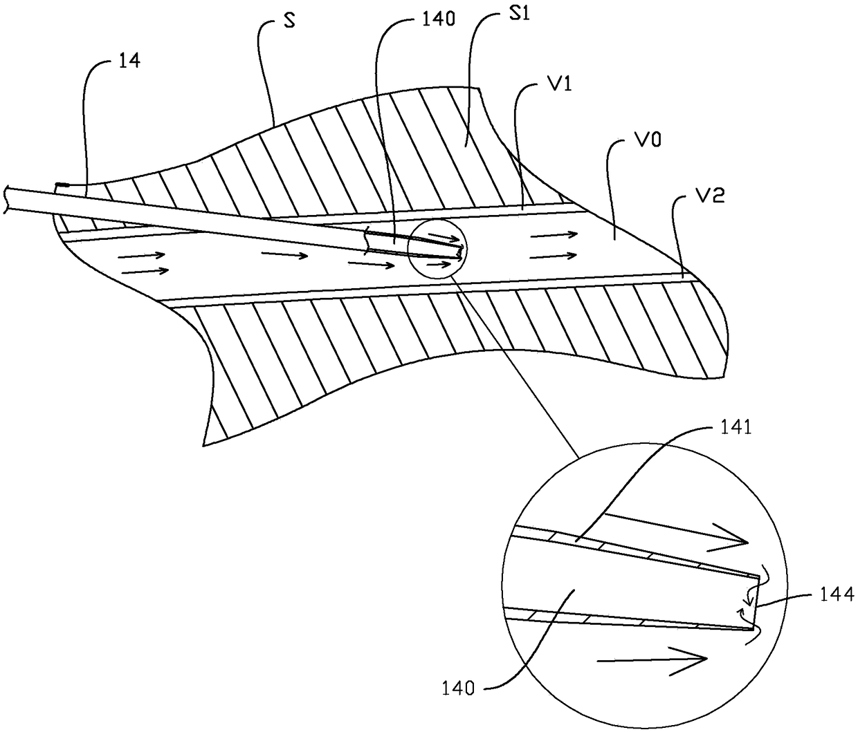 Blocking type intravenous infusion catheter device