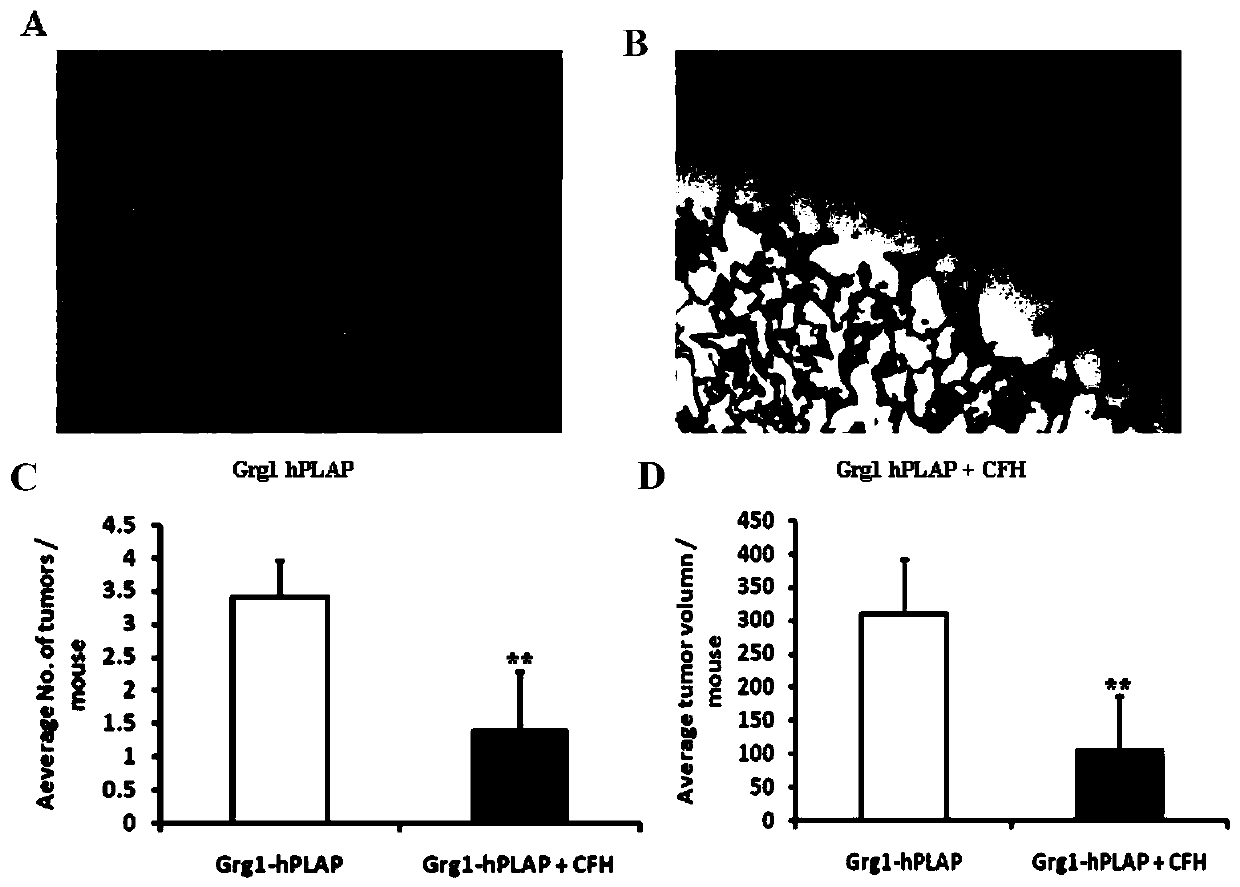 Applications of complement factor H (CFH) in preparing anti-lung adenocarcinoma drug