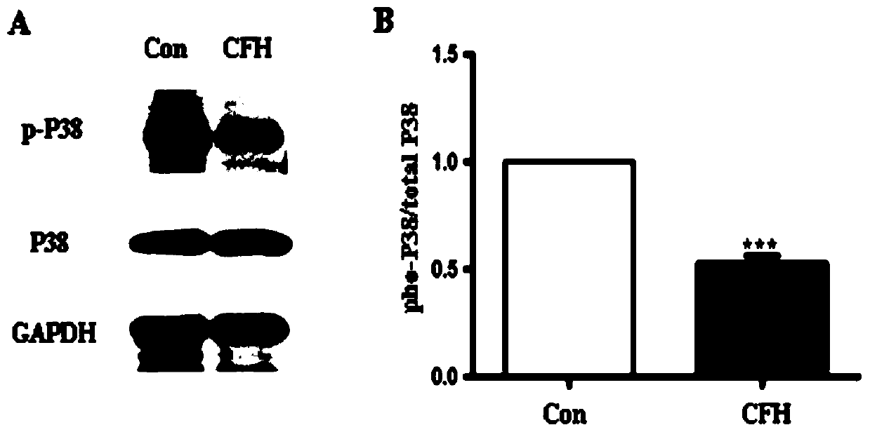 Applications of complement factor H (CFH) in preparing anti-lung adenocarcinoma drug