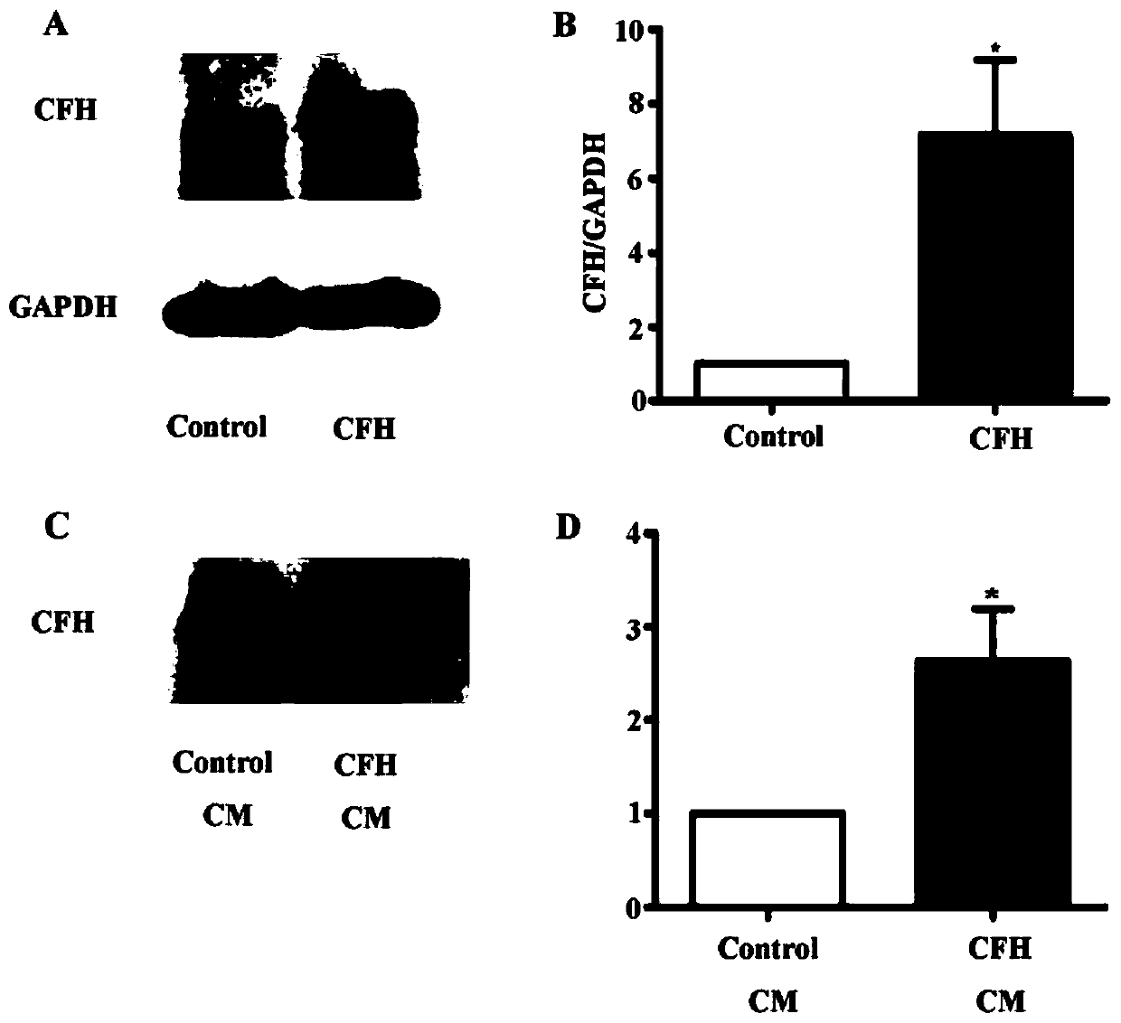 Applications of complement factor H (CFH) in preparing anti-lung adenocarcinoma drug