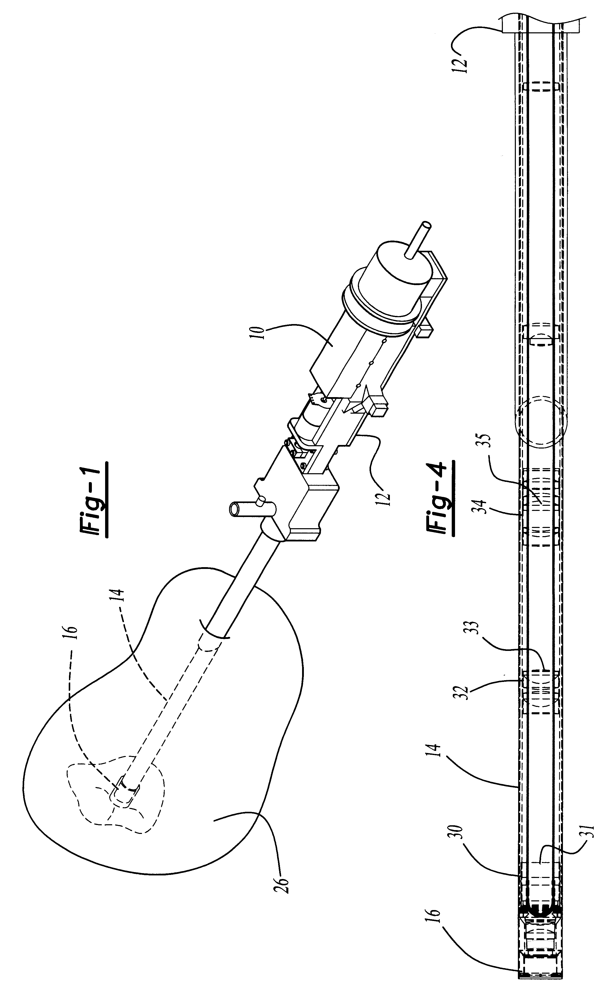 Endoscope