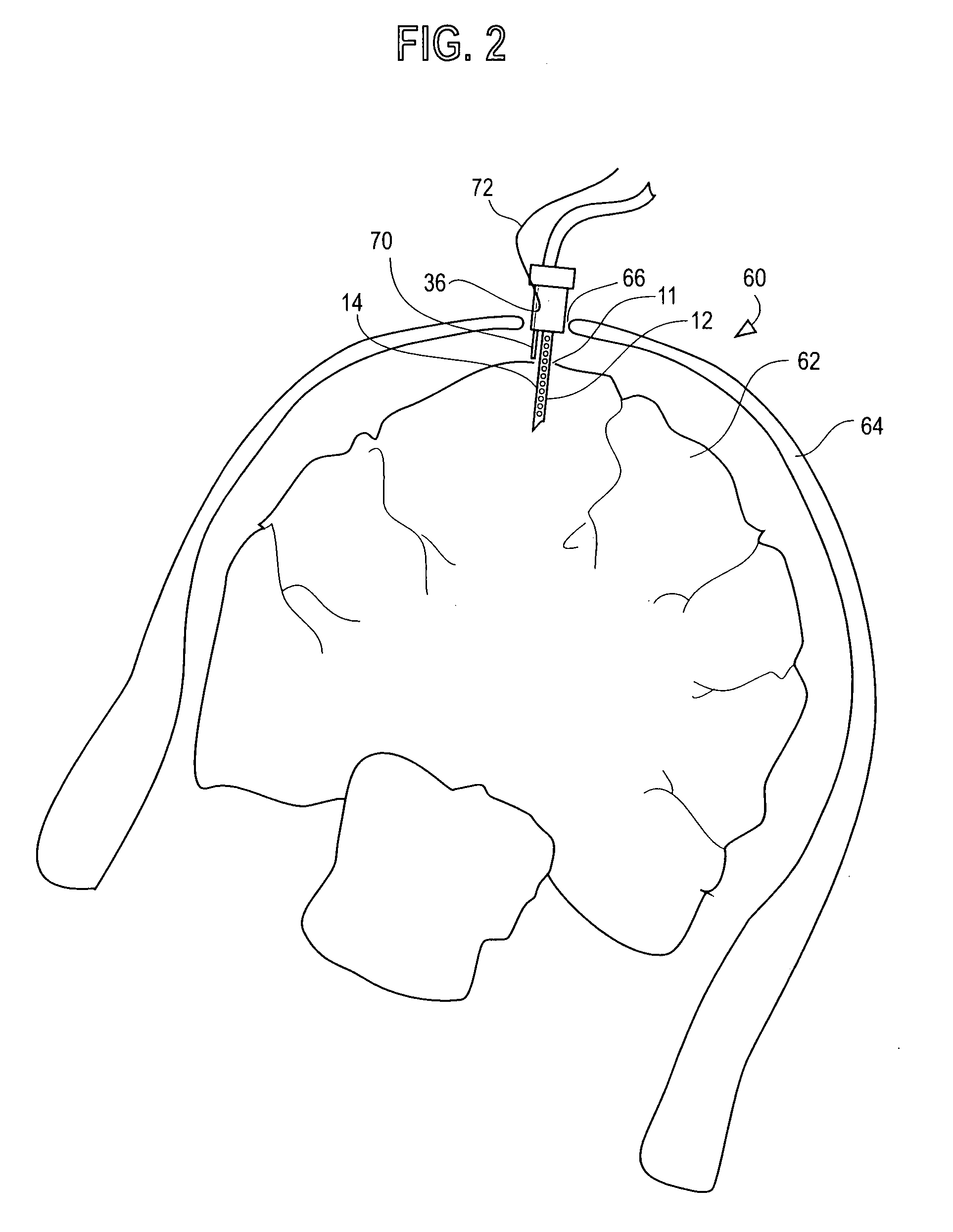 Water content probe