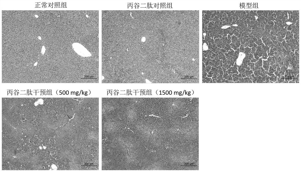 Application of alanyl-glutamine (Ala-Gln) in preparation of medicine for preventing and treating acute liver failure