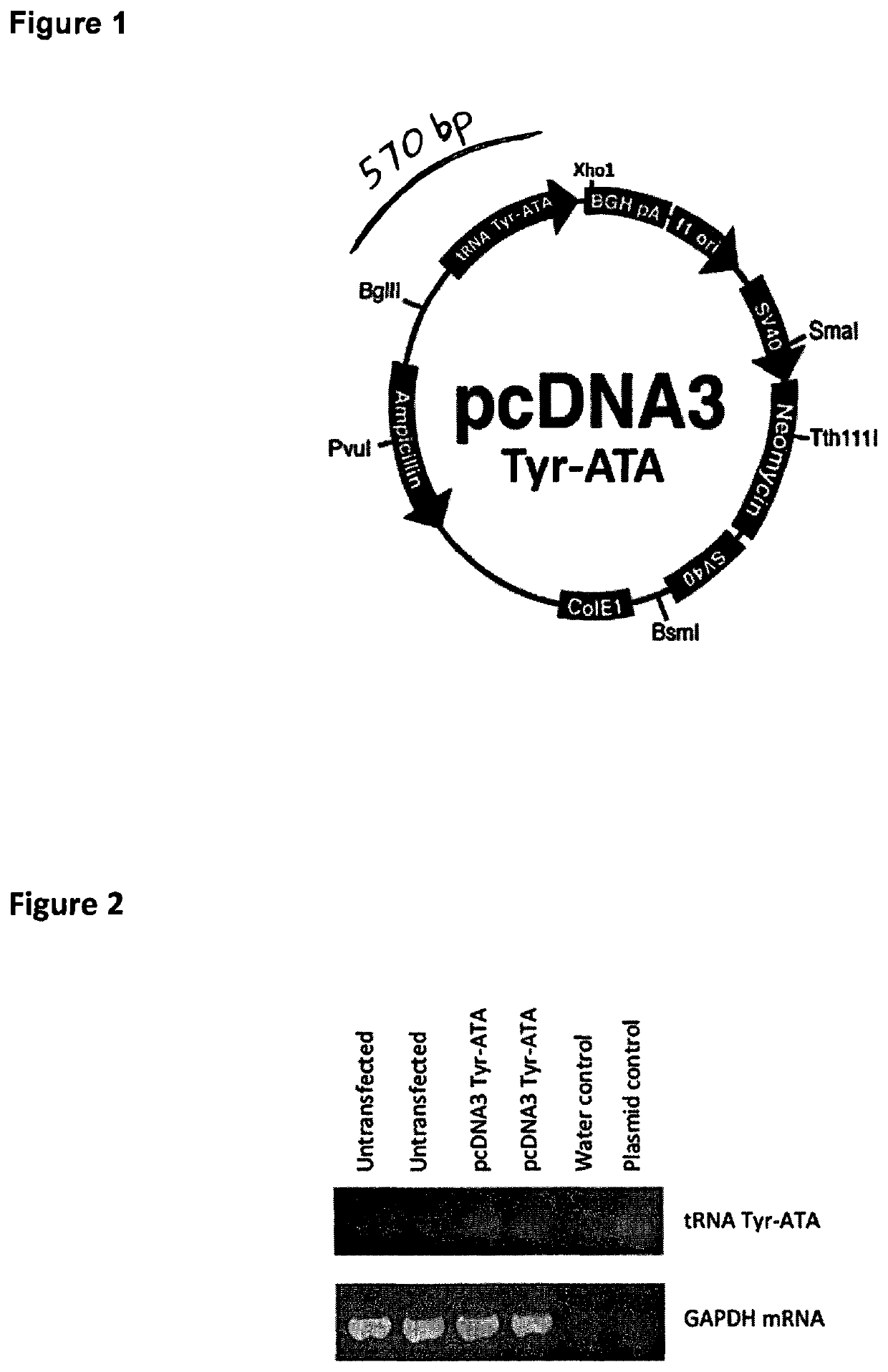 Recombinant protein production