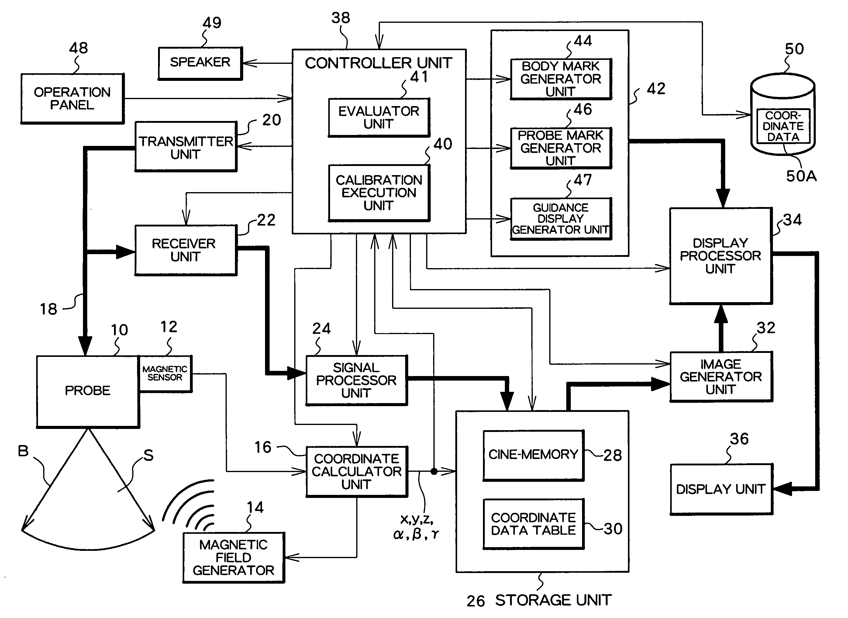 Ultrasound diagnosis apparatus