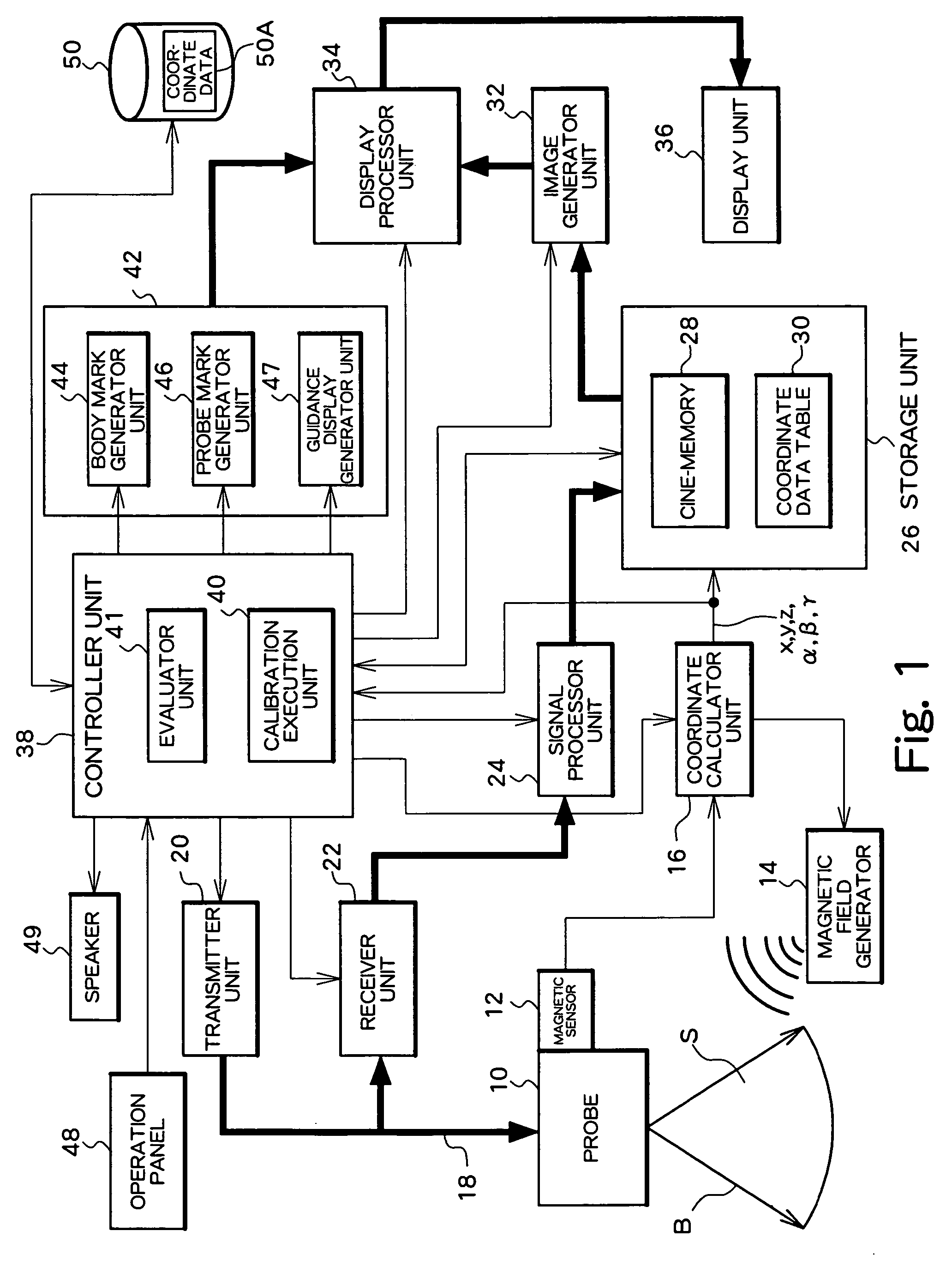 Ultrasound diagnosis apparatus