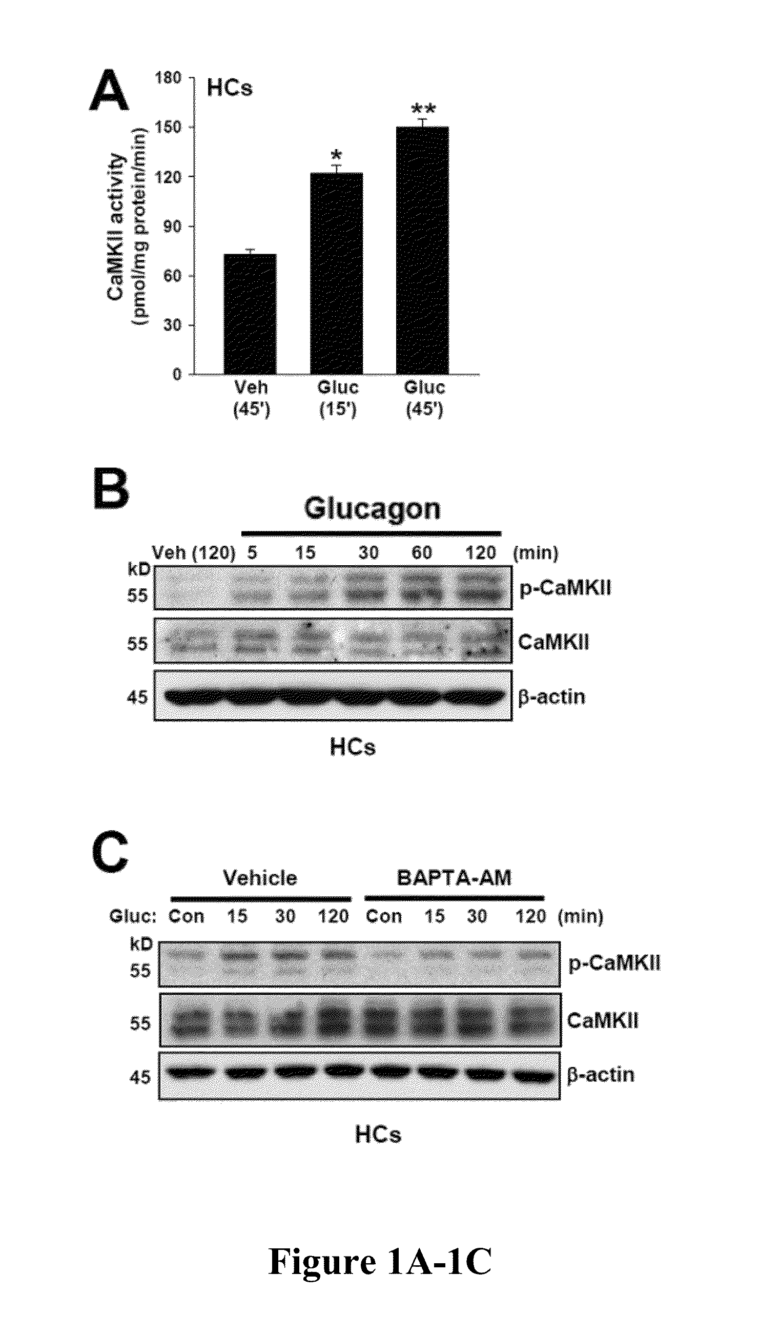 CaMKII, IP3R, CALCINEURIN, P38 AND MK2/3 INHIBITORS TO TREAT METABOLIC DISTURBANCES OF OBESITY