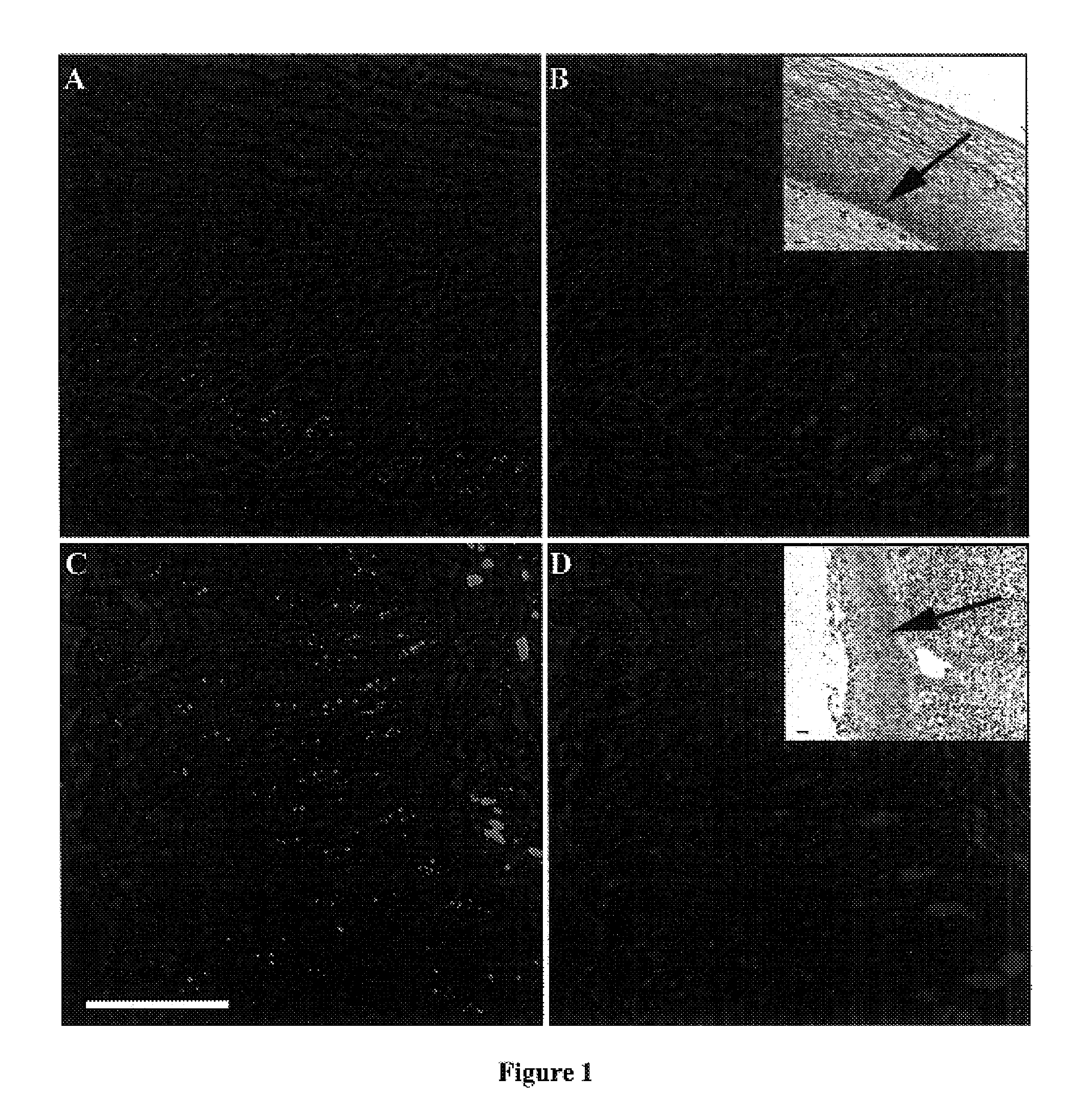 Methods of cytodiagnostic staging of neoplasia and squamous cell carcinoma