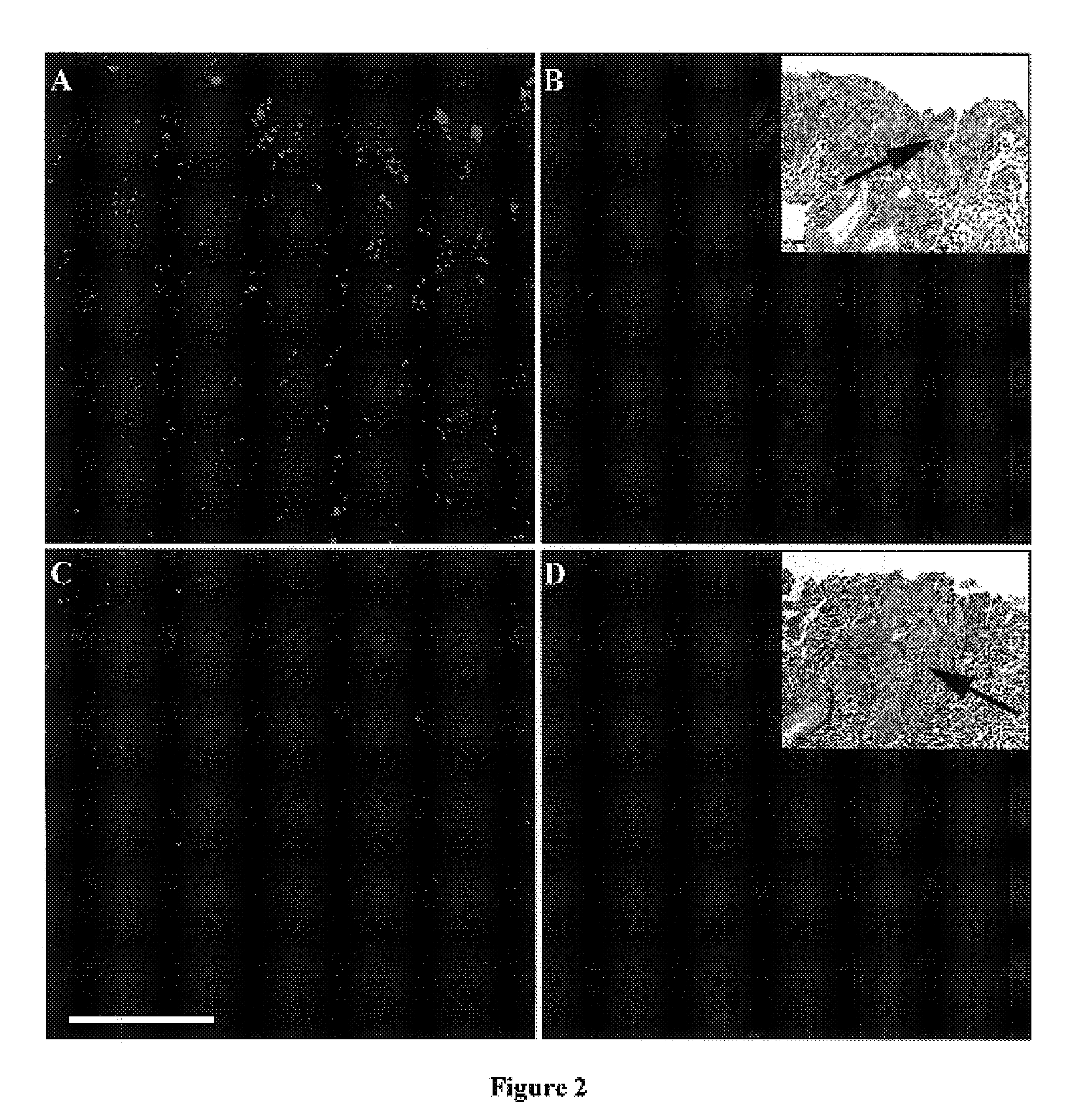 Methods of cytodiagnostic staging of neoplasia and squamous cell carcinoma