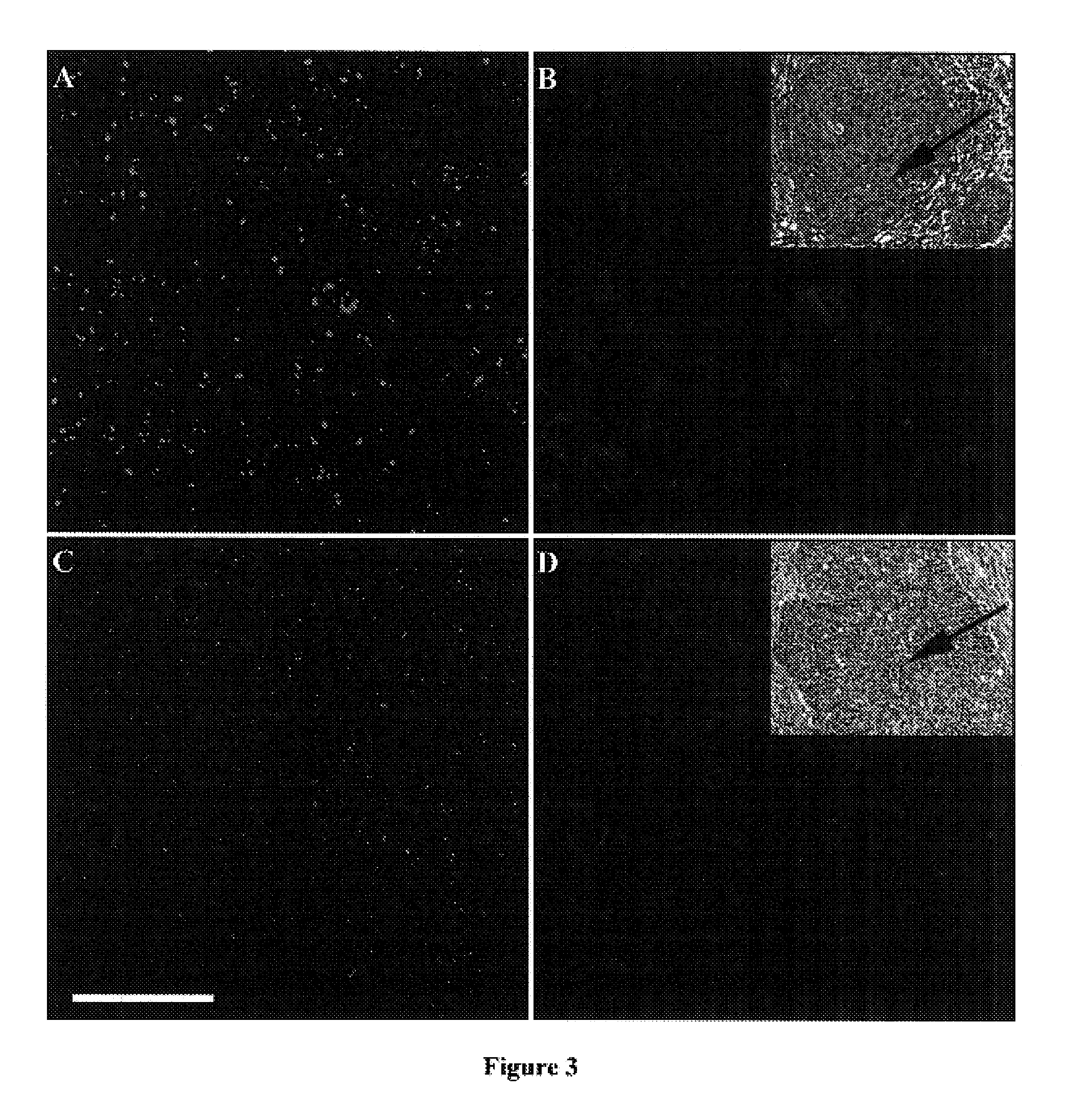 Methods of cytodiagnostic staging of neoplasia and squamous cell carcinoma