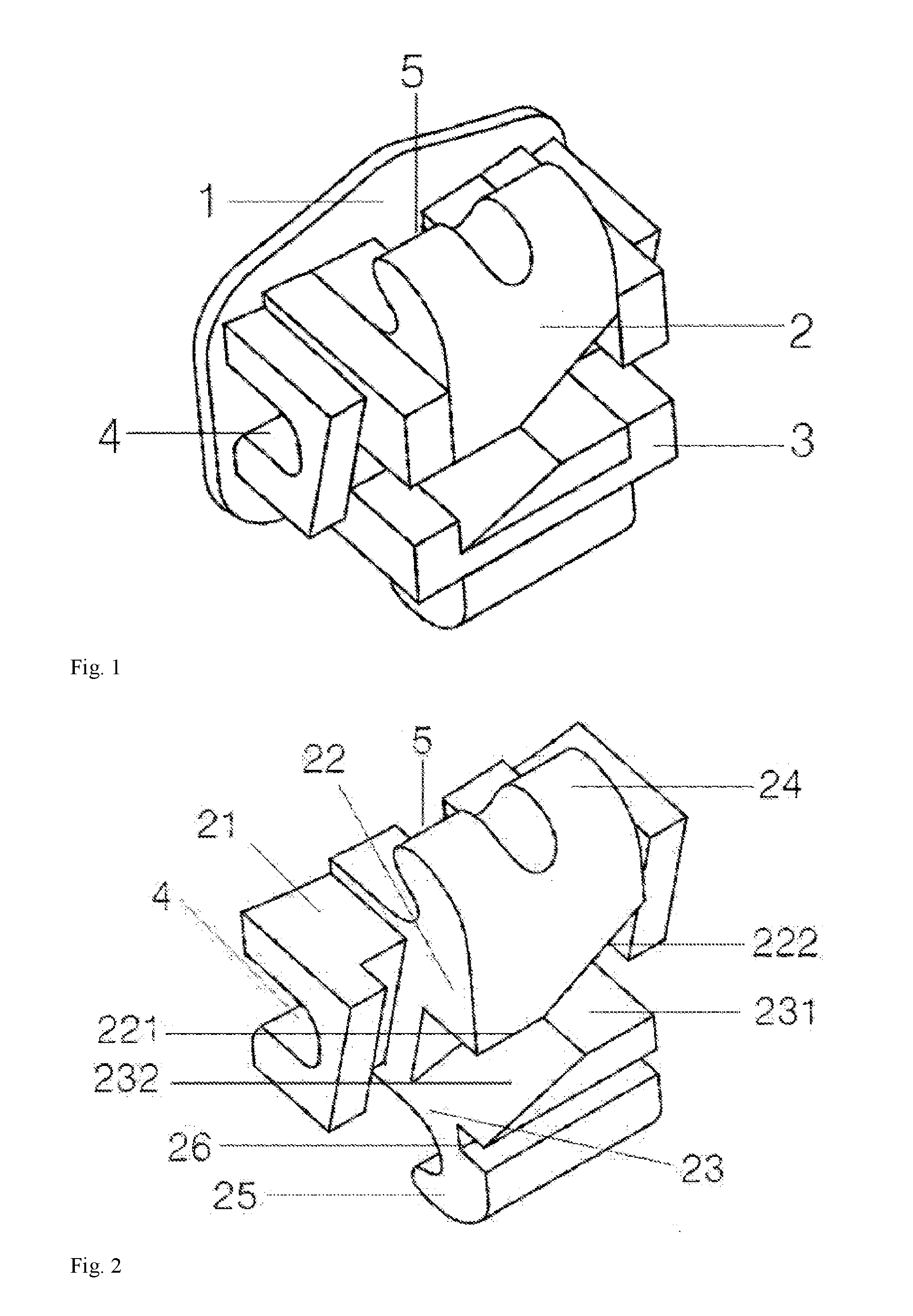 Orthodontic Treatment Bracket