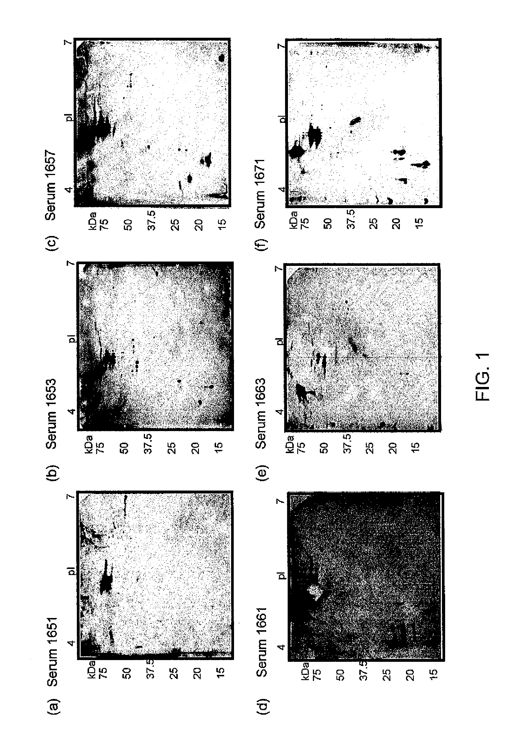 Immunoreactive francisella tularensis antigens