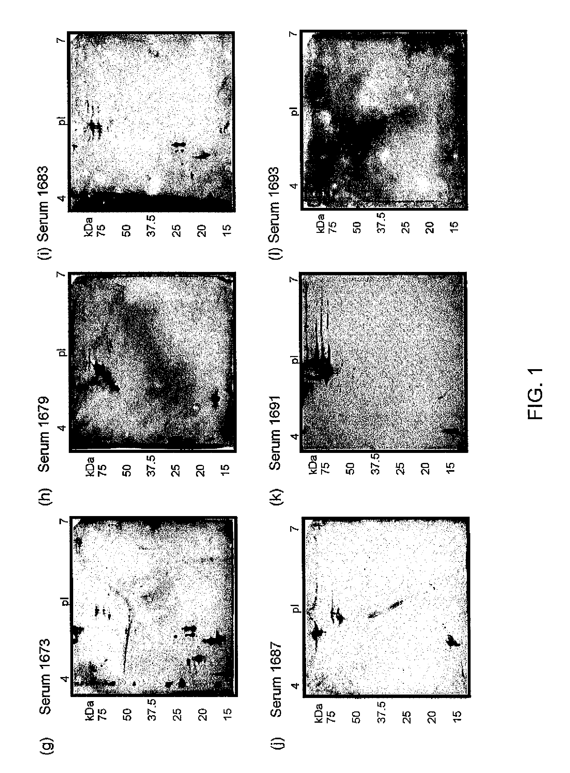 Immunoreactive francisella tularensis antigens