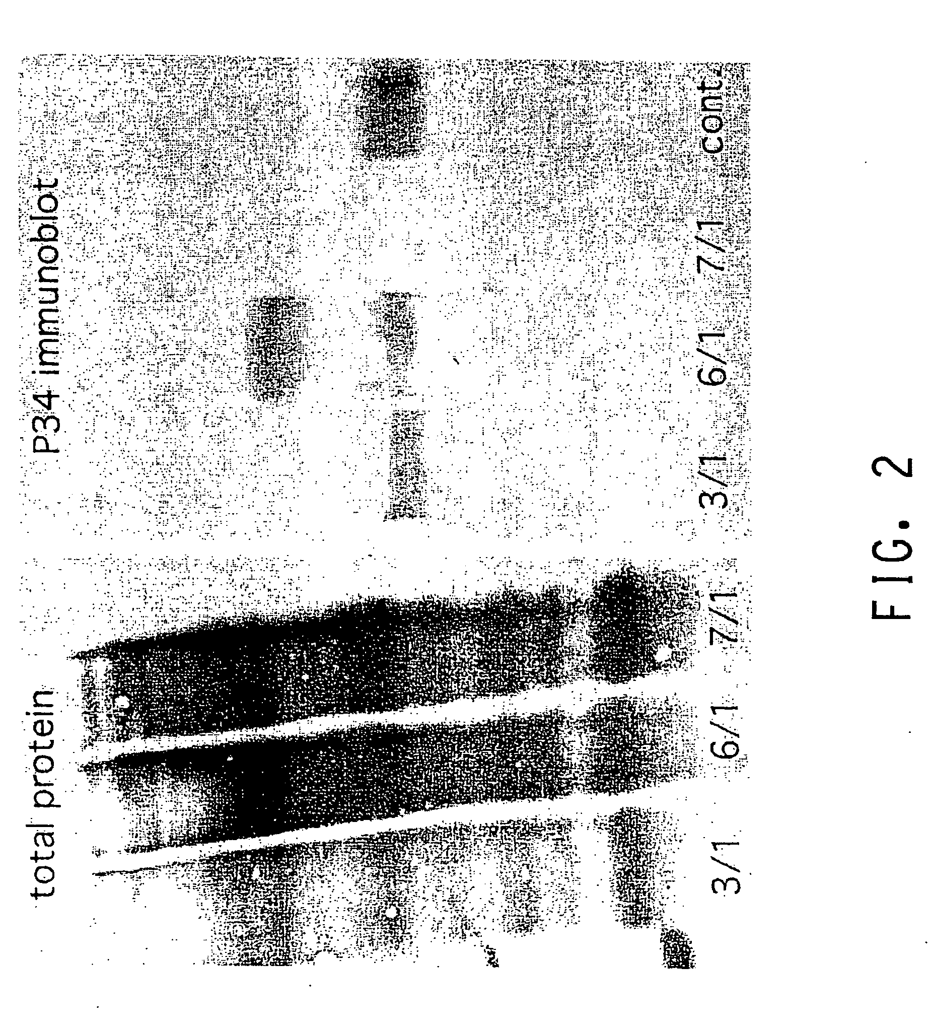 Hypoallergenic transgenic soybeans