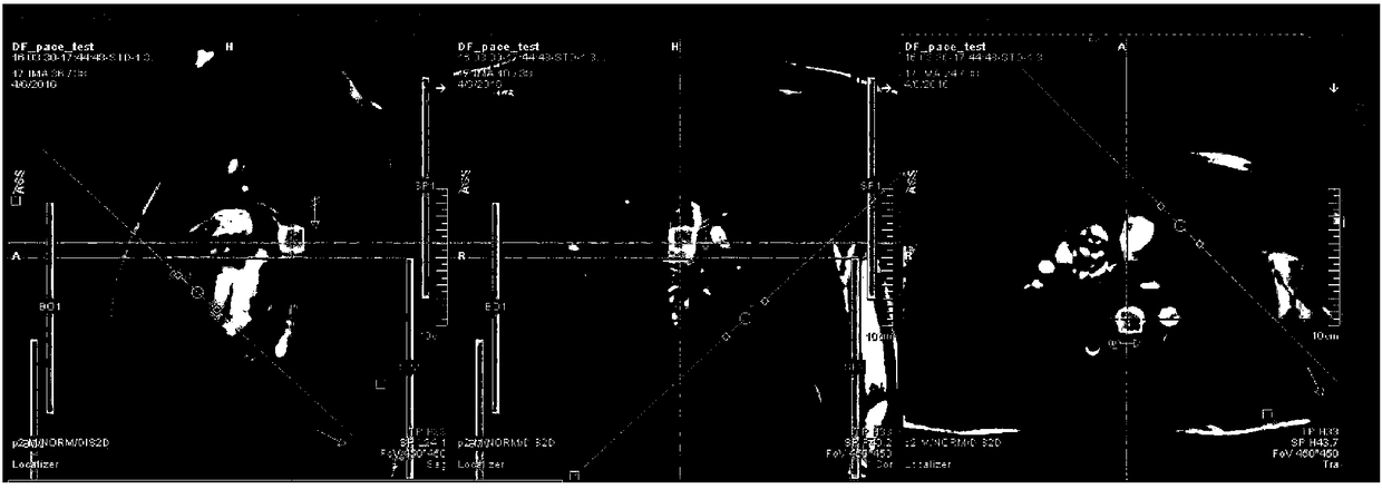 Prospective electrocardiography triggering method and device