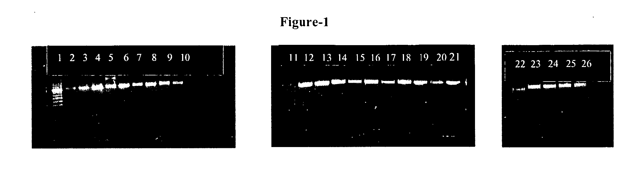 Methods for detection of mycobacterium tuberculosis