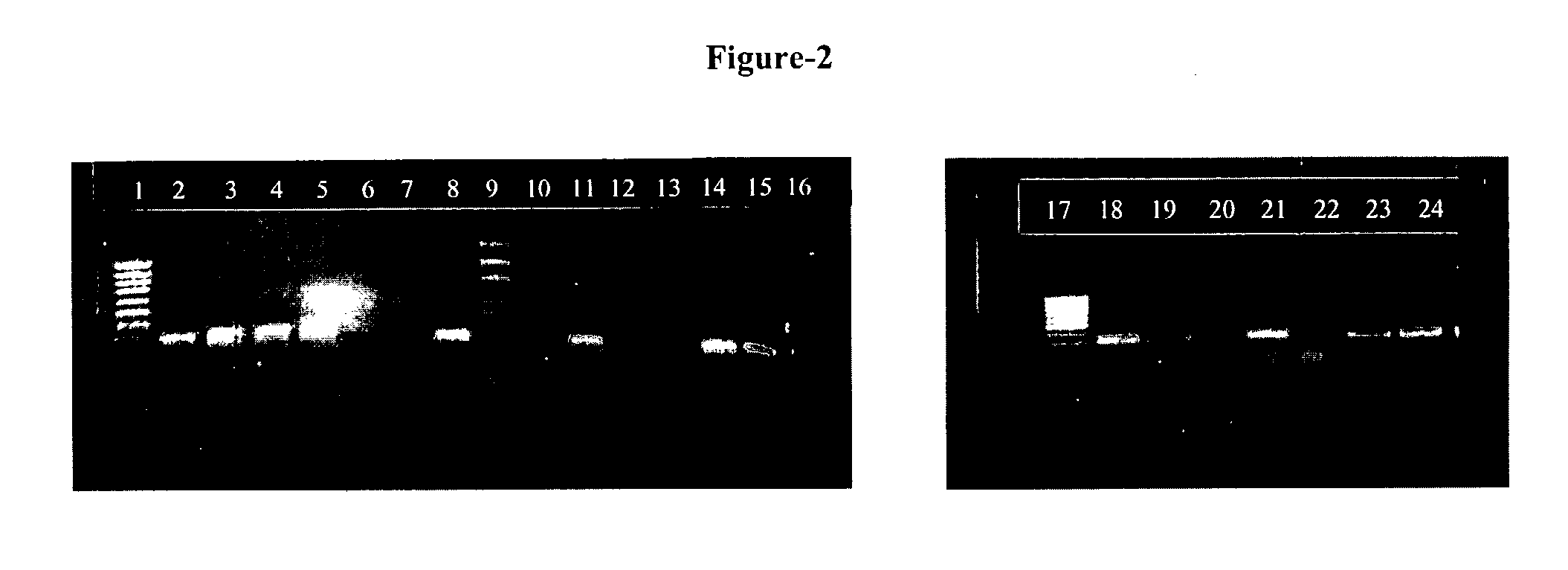 Methods for detection of mycobacterium tuberculosis