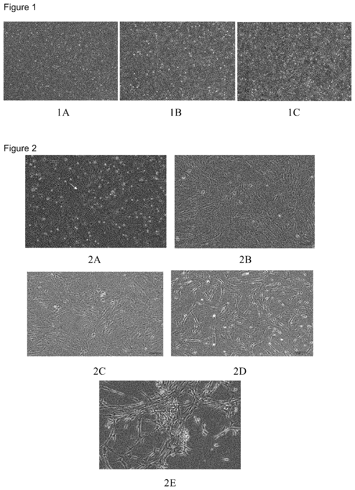 Reagent kit for step-by-step hUC-MSC culture and hUC-MSC acquired using said reagent kit