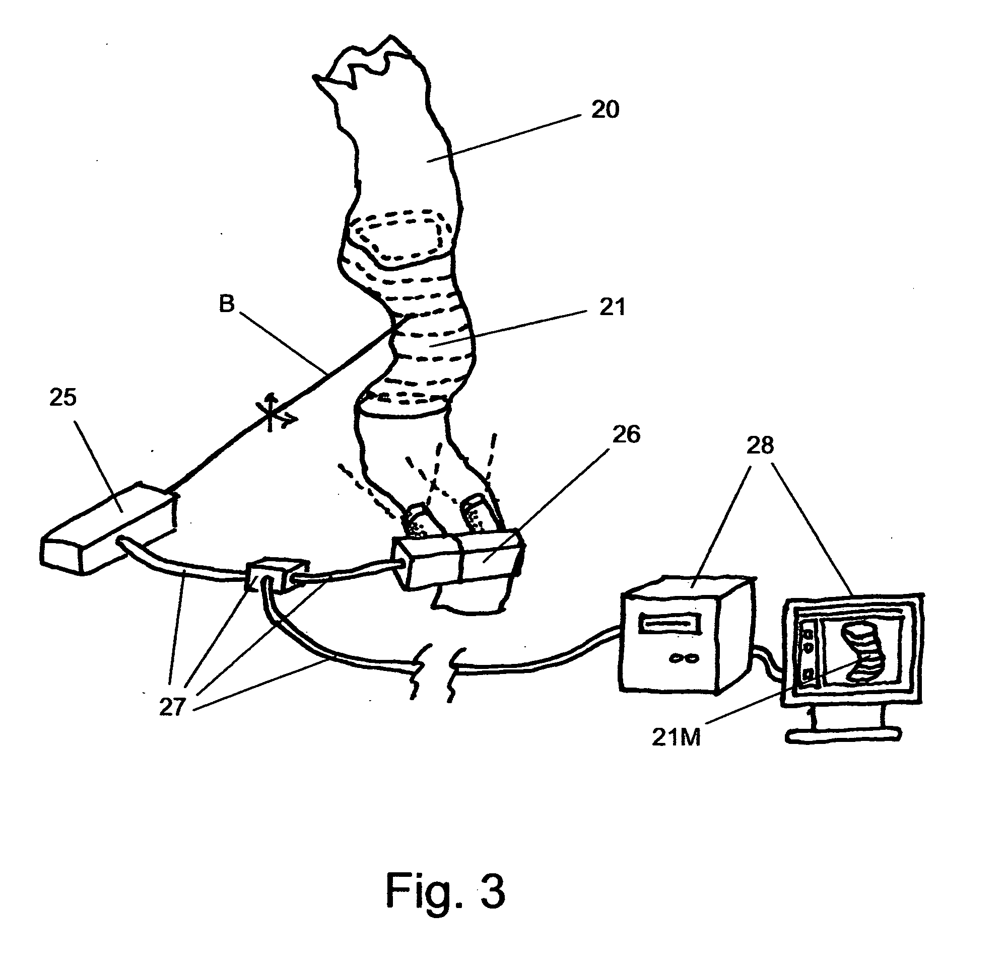 Custom clamps for deep-sea oil containment