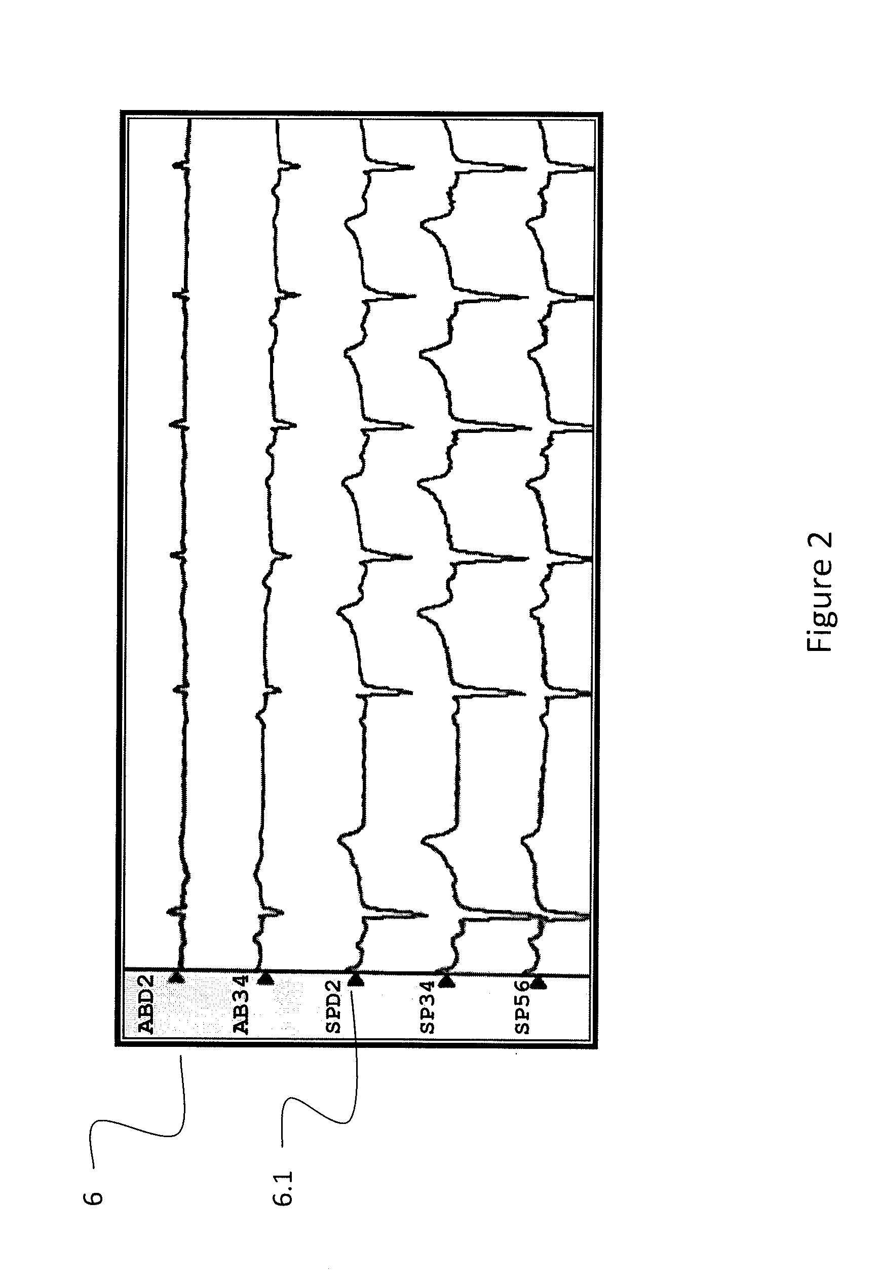 System and method for targeting catheter electrodes