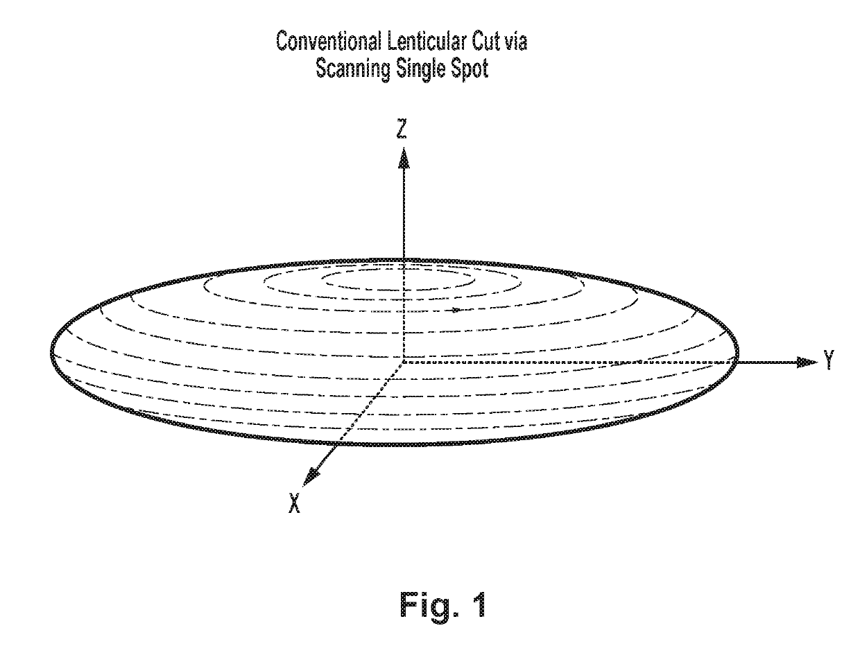 Systems and methods for high speed modulation of a resonant scanner in ophthalmic laser applications